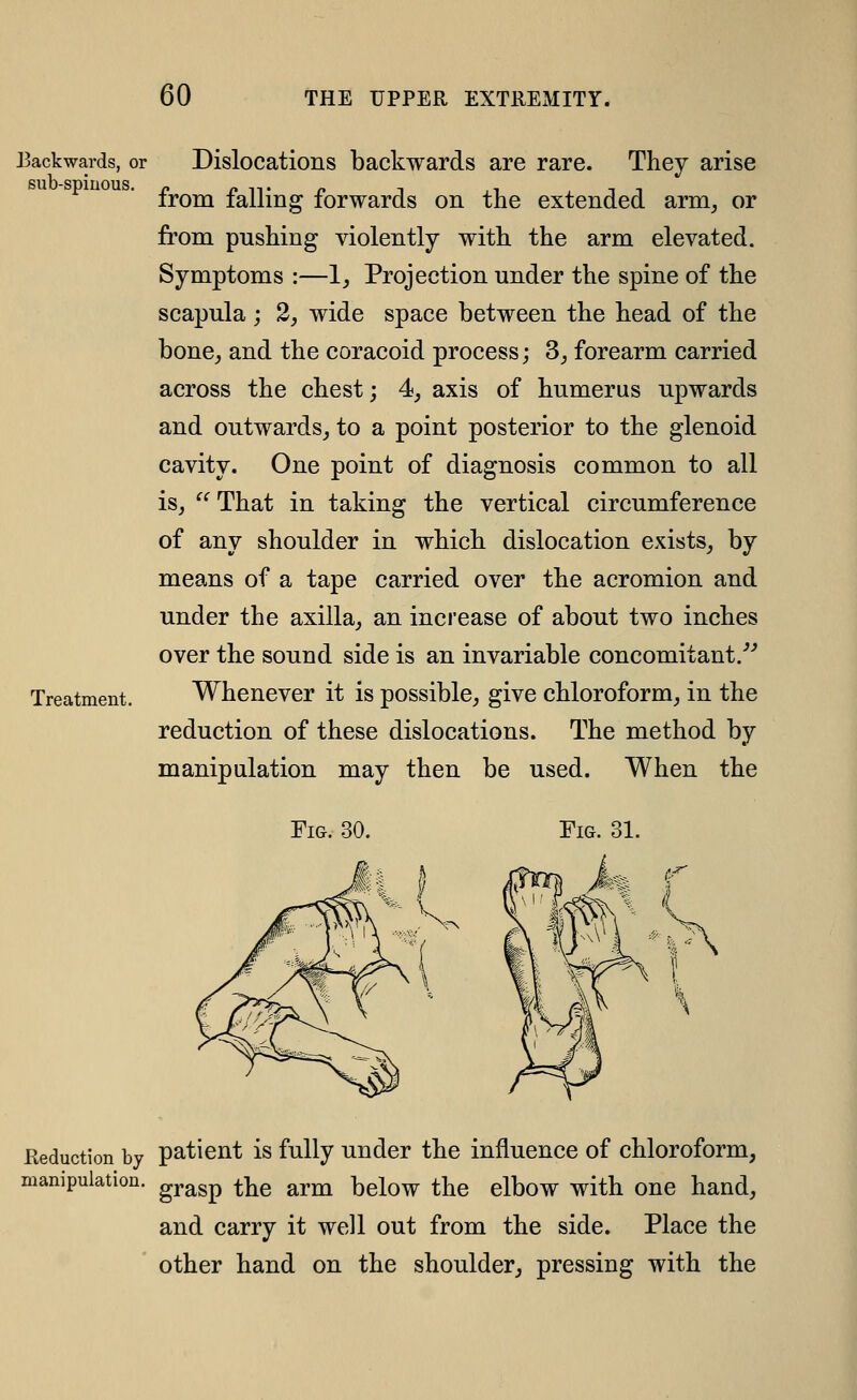 IBackwards, or sub-spiuous. Treatment. Dislocations backwards are rare. They arise from falling forwards on the extended arm, or from pushing violently with the arm elevated. Symptoms :—1, Projection under the spine of the scapula ; 2, wide space between the head of the bone, and the coracoid process; S, forearm carried across the chest; 4, axis of humerus upwards and outwards, to a point posterior to the glenoid cavity. One point of diagnosis common to all is, ^^That in taking the vertical circumference of any shoulder in which dislocation exists, by means of a tape carried over the acromion and under the axilla, an increase of about two inches over the sound side is an invariable concomitant/^ Whenever it is possible, give chloroform, in the reduction of these dislocations. The method by manipulation may then be used. When the Fig. 30 Reduction by patient is fully under the influence of chloroform, manipulation, g^^sp the arm below the elbow with one hand, and carry it well out from the side. Place the ' other hand on the shoulder, pressing with the