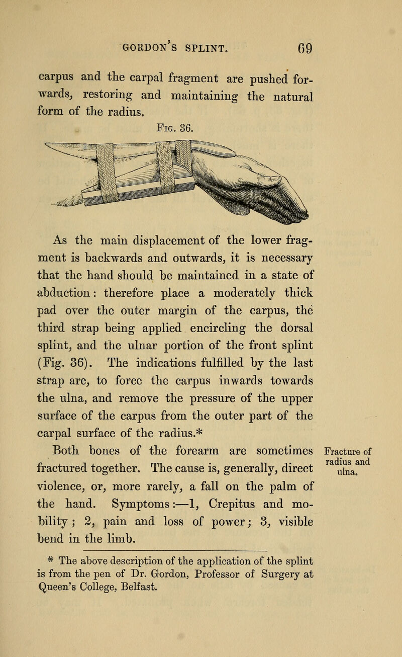 carpus and the carpal fragment are pushed for- wards, restoring and maintaining the natural form of the radius. Fig. 36. As the main displacement of the lower frag- ment is backwards and outwards, it is necessary that the hand should be maintained in a state of abduction: therefore place a moderately thick pad over the outer margin of the carpus, the third strap being applied encircling the dorsal splint, and the ulnar portion of the front splint (Fig. 36). The indications fulfilled by the last strap are, to force the carpus inwards towards the ulna, and remove the pressure of the upper surface of the carpus from the outer part of the carpal surface of the radius.* Both bones of the forearm are sometimes Fracture of fractured together. The cause is, generally, direct ^Ina. violence, or, more rarely, a fall on the palm of the hand. Symptoms:—1, Crepitus and mo- bility ; 2, pain and loss of power; 3, visible bend in the limb. * The above description of the application of the splint is from the pen of Dr. Gordon, Professor of Surgery at Queen's College, Belfast.