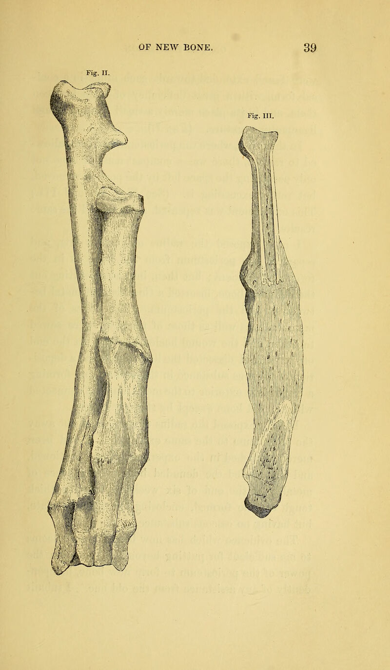 Fig. II. 1 m Fig. III.