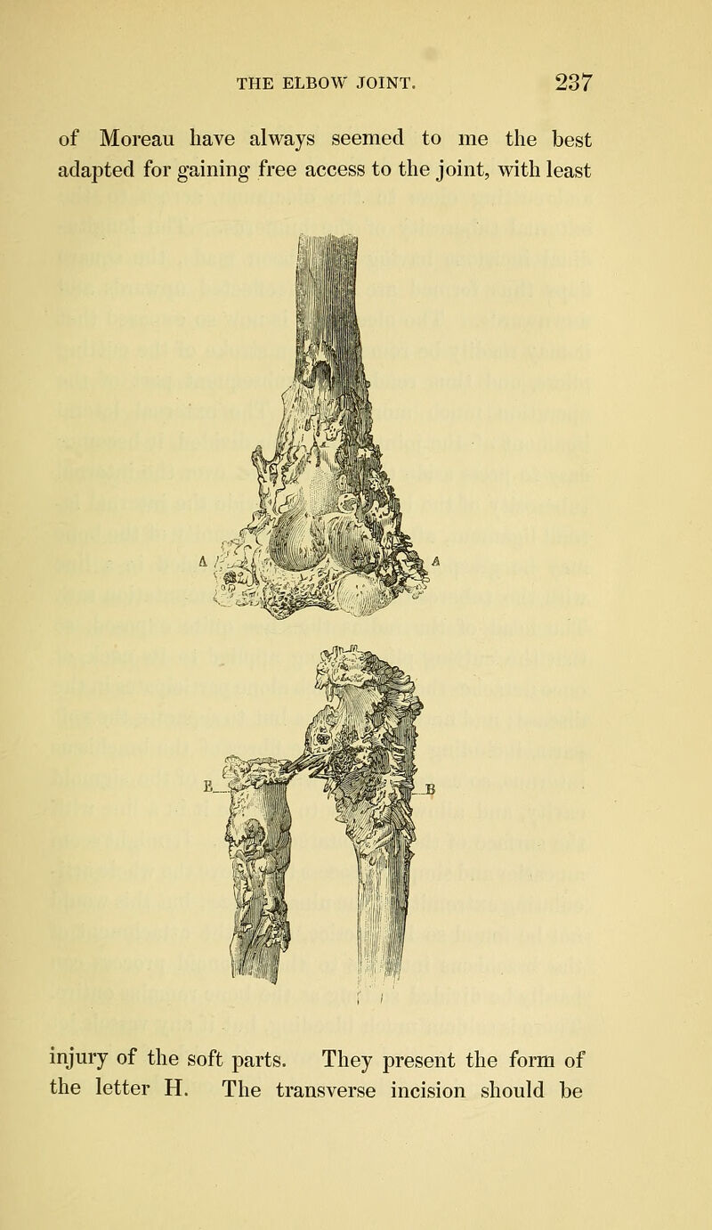 of Moreau have always seemed to me the best adapted for gaining free access to the joint, with least injury of the soft parts. They present the form of the letter H. The transverse incision should be