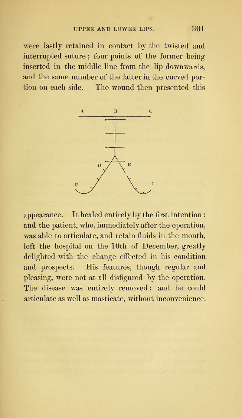 were lastly retained in contact by the twisted and interrupted suture; four points of the former being- inserted in the middle line from the lip downwards, and the same number of the latter in the curved por- tion on each side. The wound then presented this • appearance. It healed entirely by the first intention ; and the patient, who, immediately after the operation, was able to articulate, and retain fluids in the mouth, left the hospital on the 10th of December, greatly delighted with the change effected in his condition and prospects. His features, though regular and pleasing, were not at all disfigured by the operation. The disease was entirely removed; and he could articulate as well as masticate, without inconvenience,