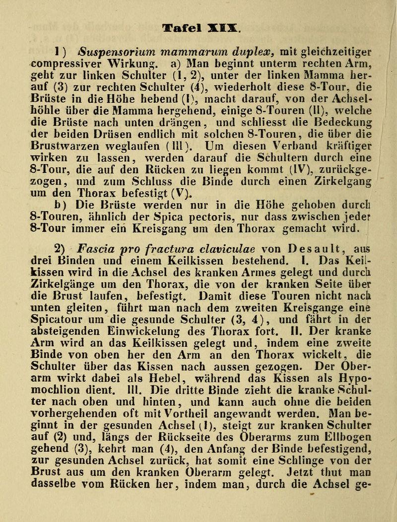 Tafel MX. 1) Suspensorium mammarum duplex, mit gleichzeitiger compressiver Wirkung, a) Man beginnt unterm rechten Arm, geht zur linken Schulter (1,2), unter der linken Mamma her- auf (3) zur rechten Schulter (4), wiederholt diese 8-Tour, die Brüste in die Höhe hebend (1), macht darauf, von der Achsel- höhle über die Mamma hergehend, einige 8-Touren (11), welche die Brüste nach unten drängen, und schliesst die Bedeckung der beiden Drüsen endlich mit solchen 8-Touren, die über die Brustwarzen weglaufen (111). Um diesen Verband kräftiger wirken zu lassen, werden darauf die Schultern durch eine 8-Tour, die auf den Rücken zu liegen kommt (IV), zurückge- zogen, und zum Schluss die Binde durch einen Zirkelgang um den Thorax befestigt (V). b) Die Brüste werden nur in die Höhe gehoben durch 8-Touren, ähnlich der Spica pectoris, nur dass zwischen jeder 8-Tour immer ein Kreisgang um den Thorax gemacht wird. 2) Fascia pro fractura claviculae von Desault, aus drei Binden und einem Keilkissen bestehend. I. Das Keil- kissen wird in die Achsel des kranken Armes gelegt und durch Zirkelgänge um den Thorax, die von der kranken Seite über die Brust laufen, befestigt. Damit diese Touren nicht nach unten gleiten, führt man nach dem zweiten Kreisgange eine Spicatour um die gesunde Schulter (3, 4), und fährt in der absteigenden Einwickelung des Thorax fort. II. Der kranke Arm wird an das Keilkissen gelegt und, indem eine zweite Binde von oben her den Arm an den Thorax wickelt, die Schulter über das Kissen nach aussen gezogen. Der Ober- arm wirkt dabei als Hebel, während das Kissen als Hypo- mochlion dient. 111. Die dritte Binde zieht die kranke Schul- ter nach oben und hinten, und kann auch ohne die beiden vorhergehenden oft mit Vortheil angewandt werden. Man be- ginnt in der gesunden Achsel [l), steigt zur kranken Schulter auf (2) und, längs der Rückseite des Oberarms zum Ellbogen gehend (3), kehrt man (4), den Anfang der Binde befestigend, zur gesunden Achsel zurück, hat somit eine Schlinge von der Brust aus um den kranken Oberarm gelegt. Jetzt thut man dasselbe vom Rücken her, indem man, durch die Achsel ge-