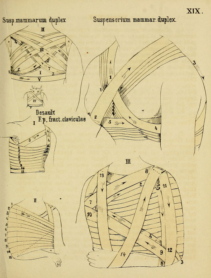 XIX. mammarum ämilex: Siisp eas oriimi mammar. duplex.