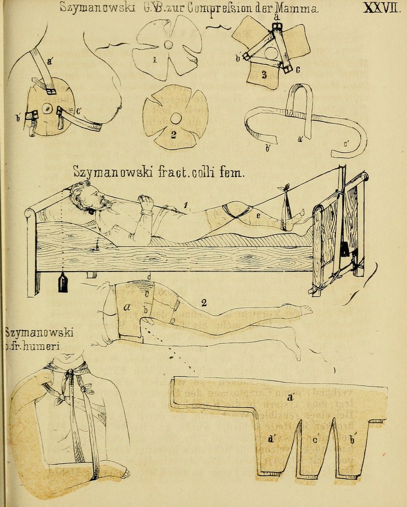 ' Szymaucwski ö^.zurOomOTelkum der Mamma. XXVI. Szym an owsld frac t. c olli fem