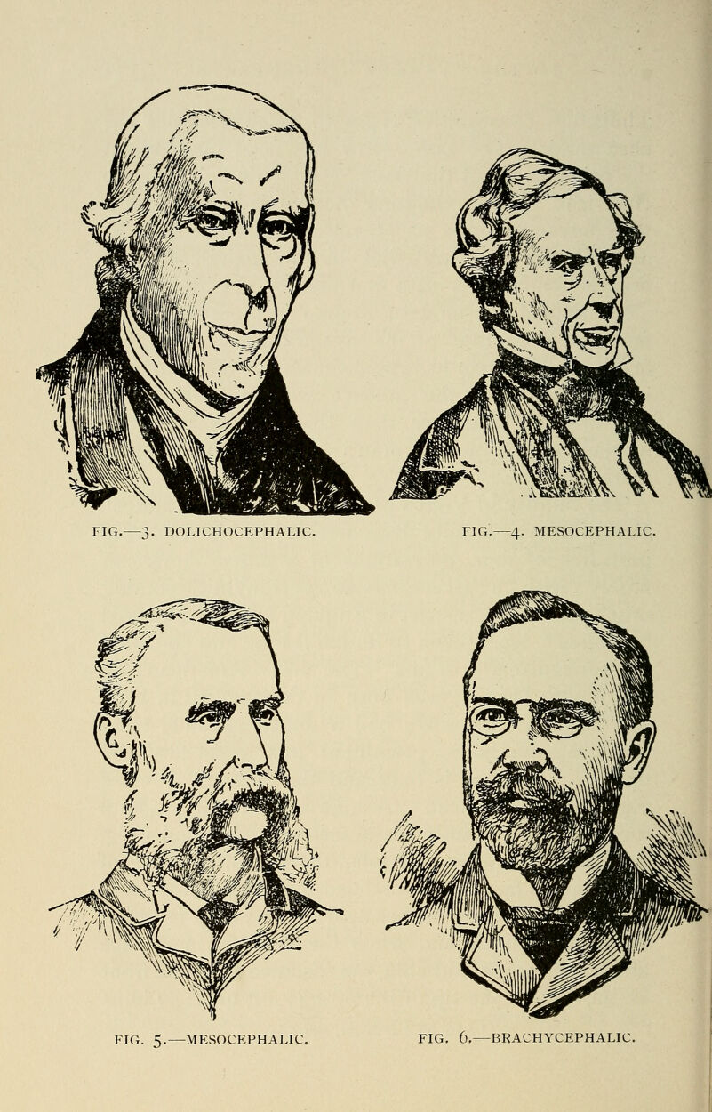 FIG.—3. DOLICHOCEPHALIC. FIG.—4. MESOCEPHALIC. FIG. 5.—MESOCEPHALIC. FIG. 6,—BRACHYCEPHALIC.