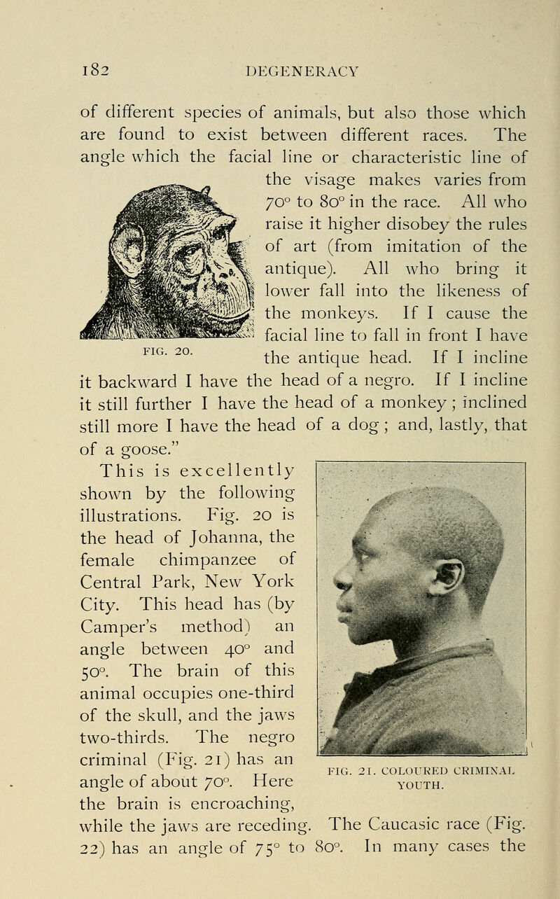 FIG. 20. of different species of animals, but also those which are found to exist between different races. The angle which the facial line or characteristic line of the visage makes varies from 70° to 80° in the race. All who raise it higher disobey the rules of art (from imitation of the antique). All who bring it lower fall into the likeness of the monkeys. If I cause the facial line to fall in front I have the antique head. If I incline it backward I have the head of a negro. If I incline it still further I have the head of a monkey; inclined still more I have the head of a dog; and, lastly, that of a goose. This is excellently shown by the following illustrations. Fig. 20 is the head of Johanna, the female chimpanzee of Central Park, New York City. This head has (by Camper's method) an angle between 40° and 50°. The brain of this animal occupies one-third of the skull, and the jaws two-thirds. The negro criminal (Fig. 21) has an angle of about 70°. Here the brain is encroaching, while the jaws are receding. The Caucasic race (Fig. 22) has an angle of 75° to 80°. In many cases the P^IG. 21. COLOURED CRIMINAL YOUTH.