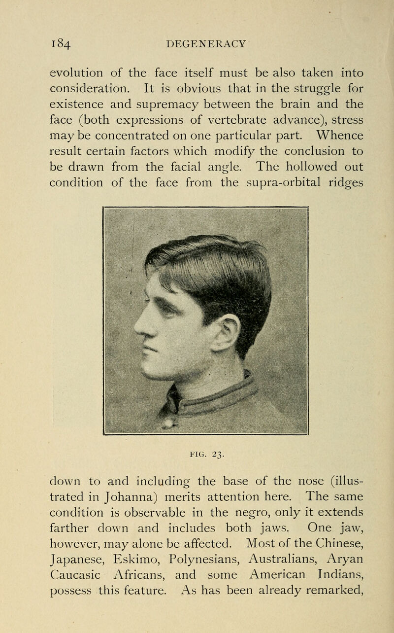 evolution of the face itself must be also taken into consideration. It is obvious that in the struggle for existence and supremacy between the brain and the face (both expressions of vertebrate advance), stress may be concentrated on one particular part. Whence result certain factors which modify the conclusion to be drawn from the facial angle. The hollowed out condition of the face from the supra-orbital ridges FIG. 23. down to and including the base of the nose (illus- trated in Johanna) merits attention here. The same condition is observable in the negro, only it extends farther down and includes both jaws. One jaw, however, may alone be affected. Most of the Chinese, Japanese, Eskimo, Polynesians, Australians, Aryan Caucasic Africans, and some American Indians, possess this feature. As has been already remarked,