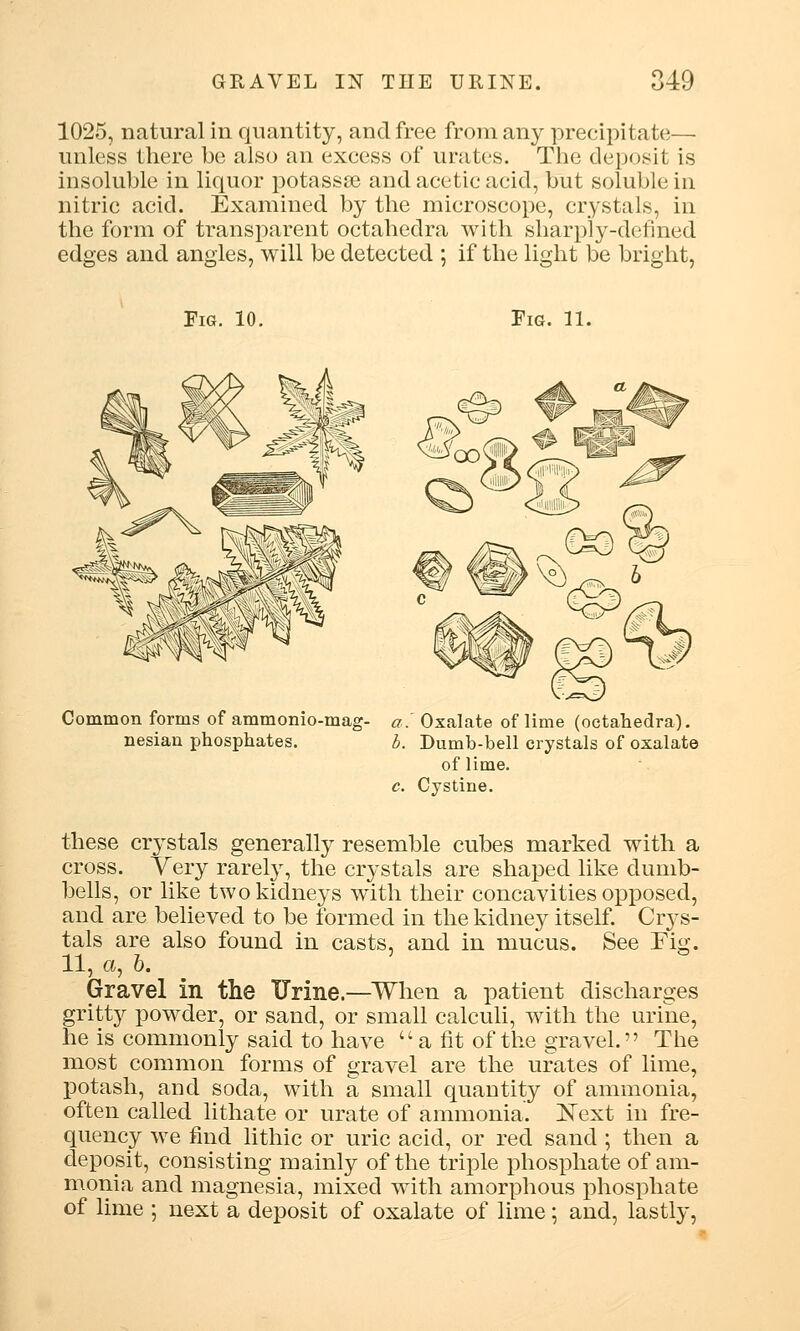 1025, natural in quantity, and free from any precipitate— unless there be also an excess of urates. The deposit is insoluble in liquor potassse and acetic acid, but soluble in nitric acid. Examined by the microscope, crystals, in the form of transparent octaheclra with sharply-defined edges and angles, will be detected ; if the light be bright, Fig. 10. Fig. 11. Common forms of ammonio-mag- nesian phosphates. '.'Oxalate of lime (oetahedra). '. Dumb-bell crystals of oxalate of lime. i. Cystine. these crystals generally resemble cubes marked with a cross. Very rarely, the crystals are shaped like dumb- bells, or like two kidneys with their concavities opposed, and are believed to be formed in the kidney itself. Crys- tals are also found in casts, and in mucus. See Fig. 11, a, b. Gravel in the Urine.—When a patient discharges gritty powder, or sand, or small calculi, with the urine, he is commonly said to have u a fit of the gravel. The most common forms of gravel are the urates of lime, potash, and soda, with a small quantity of ammonia, often called lithate or urate of ammonia. Next in fre- quency we find lithic or uric acid, or red sand ; then a deposit, consisting mainly of the triple phosphate of am- monia and magnesia, mixed with amorphous phosphate of lime ; next a deposit of oxalate of lime; and, lastly,