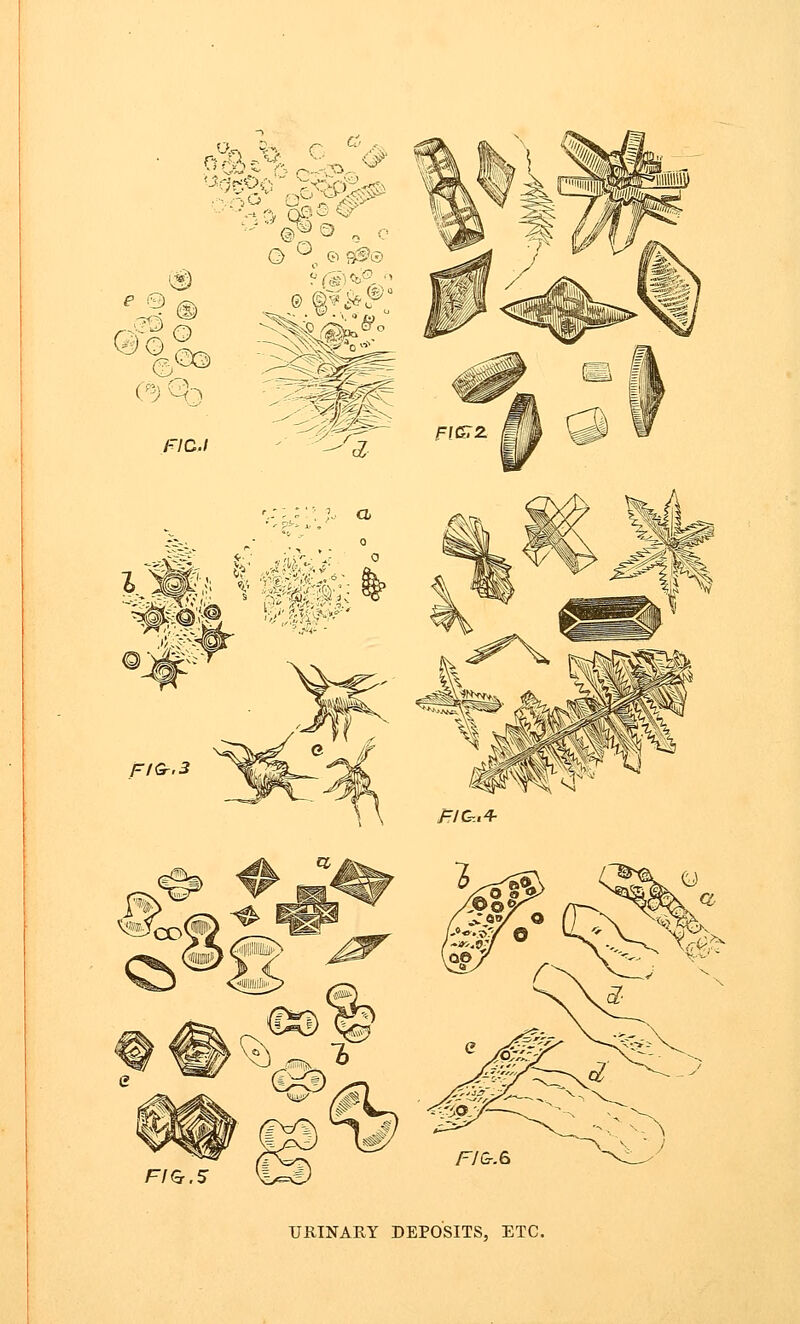 u<% vs, r F/G.S URINARY DEPOSITS, ETC.