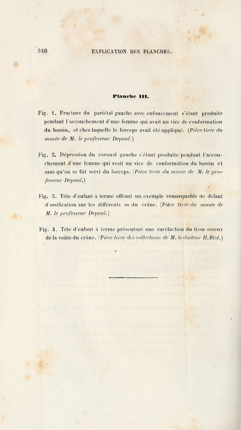 Planche III. Fig. 1. Fracture du pariétal gauche avec enfoncement s'étant produite pendant l'accouchement d'une femme qui avait un vice de conformation du bassin, et chez laquelle le forceps avait été appliqué. (Pièce tirée du musée de M. le professeur Depaul.) Fig. 2. Dépression du coronal gauche s'étant produite pendant l'accou- chement d'une femme qui avait un vice de conformation du bassin et sans qu'on se fût servi du forceps. (Pièce tirée du musée de M. le pro- fesseur Depaul.) Fig. 3. Tête d'enfant à terme offrant un exemple remarquable de défaut d'ossification sur les différents os du crâne. (Pièce tirée du musée de M. le professeur Depaul. ) Fig. à. Tète d'enfant à terme présentant une raréfaction du tissu osseux de la voûte du crâne. (Pièce tirée des collections de M. le docteur H.Blot.)