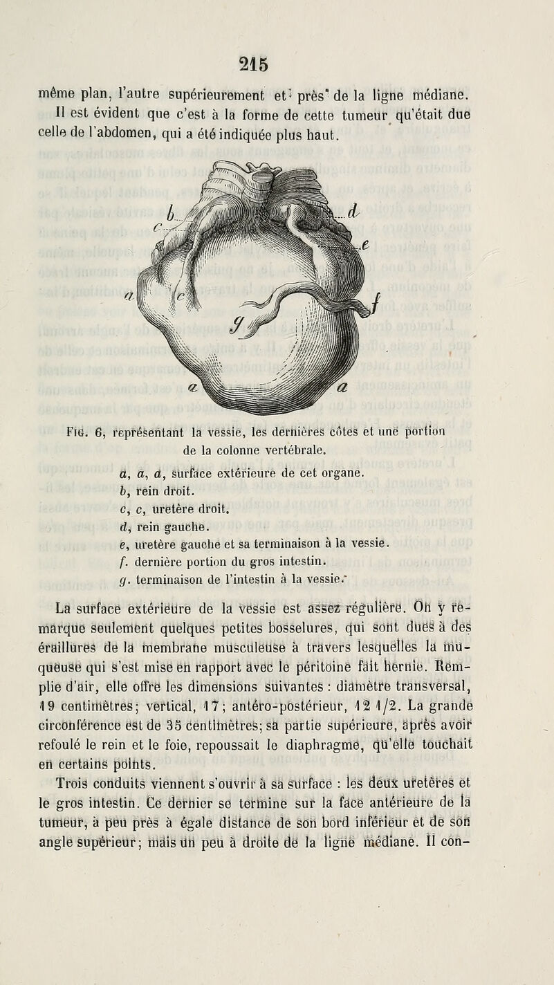 même plan, l'autre supérieurement et'^ près'de la ligne médiane. Il est évident que c'est à la forme de cette tumeur qu'était due celle de l'abdomen, qui a été indiquée plus haut. Fie. 6, représentant la vessie, les dernières côtes et une portion de la colonne vertébrale. a, a, û, surface extérieure de cet organe, fc, rein droit. c, c, uretère droit. d, rein gauche. e, uretère gauche et sa terminaison à la vessie. f, dernière portion du gros intestin. g, terminaison de l'intestin à la vessie. La surface extérieure de la vessie est às§éz régulièfë. Oh y re- marque seuleiiiërit quelques petites bosselures, ^ui sôrit dues à des éraillures de la tnembrane musculeuse à travers lesquelles la triu- queuse qui s'est mise en rapport avec le péritoine fâit hernie. Rem- plie d'air, elle offre les dimensions suivantes : diamètre transversal, 19 centimètres; vertical, 17; antéro-postérieur, 12 1/2. La grande circonférence est de 35 centitnètreS; sa partie supérieure, après avdif refoulé le rein et le foie, repoussait le diaphragme, qu'elle touchait en certains points. Trois conduits viennent s'ouvrir à sa surface : lés Aè^t uretères et le gros intestin. Ce dernier se termine sur la face antérieure de la tumeur, à peu près à égale distance de sOii bord inférieur et de son angle supérieur; maisuti peu à droite de la ligné inédiane. Il con-