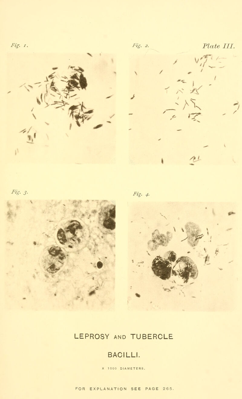 Fig. I. Fis. 2. •<. f^ / v; / mate III. / ^J Fk' 3- i ^zj'. ^• \ % LEPROSY AND TUBERCLE BACILLI. X 1000 DIAMETERS.