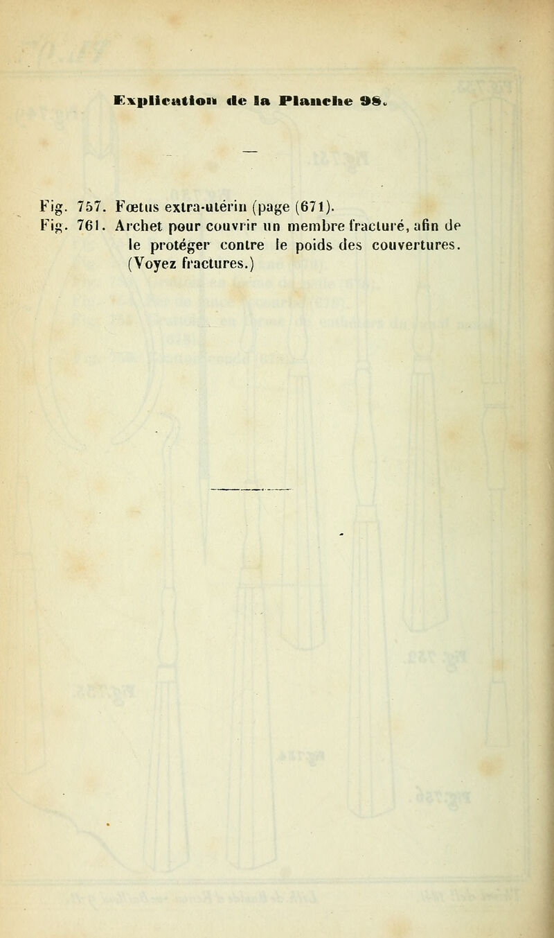 K:K|»licMiioi)i lie la Plaiiehe 9S. Fig. 757. Fœtus extra-utérin (page (671). Fif». 761. Archet pour couvrir un membre fracturé, afin de le protéger contre le poids des couvertures. (Voyez fractures.)