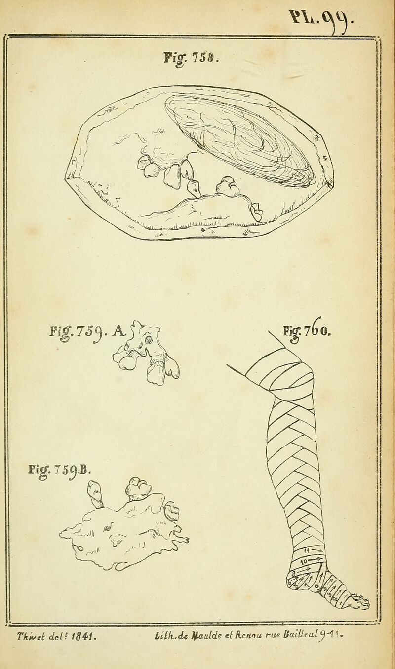 Y\i.Cv« m. fîg-.lSH, flg.JS^.AAl^^ riff. Ig. 75^.B TktvekcLtiHd^'i. LllkM Madde et Kmou rue SaiUe.a[<^-i-