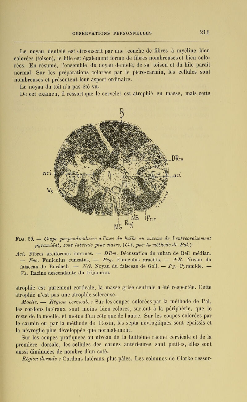 Le noyau dentelé est circonscrit par une couche de fibres à myéline bien colorées (toison), le liile est également formé de fibres nombreuses et bien colo- rées. En résumé, l'ensemble du noyau dentelé, de sa toison et du bile paraît normal. Sur les préparations colorées par le picro-carmin, les cellules sont nombreuses et présentent leur aspect ordinaire. Le noyau du toit n'a pas été vu. De cet examen, il ressort que le cervelet est atrophié en masse, mais cette FiG. 59. — Coupe perpendiculaire à l'axe du iulhe au niveau de l'entrecroisement pyramidal, zone latérale plus claire. ( Col. par la méthode de Pal.) Aci. Fibres arciformes internes. — DBin. Décussation du ruban de Keil médian. — Fnc. Funiculus cuneatus. — Fng. Funiculus gracilis. — NB. Noyau du faisceau de Burdach. — NG. Noyau du faisceau de Goll. — Py. Pyramide. — Vs. Racine descendante du trijumeau. atrophie est purement corticale, la masse grise centrale a été respectée. Cette atrophie n'est pas une atrophie scléreuse. Moelle. — Région cervicale : Sur les coupes colorées par la méthode de Pal, les cordons latéraux sont moins bien colorés, surtout à la périphérie, que le reste de la moelle, et moins d'un côté que de l'autre. Sur les coupes colorées par le carmin ou par la méthode de Rosin, les septa névrogliqiies sont épaissis et la névroglie plus développée que normalement. Sur les coupes pratiquées au niveau de la huitième racine cervicale et de la première dorsale, les cellules des cornes antérieures sont petites, elles sont aussi diminuées de nombre d'un côté. Région dorsale : Cordons latéraux plus pâles. Les colonnes de Clarke ressor-