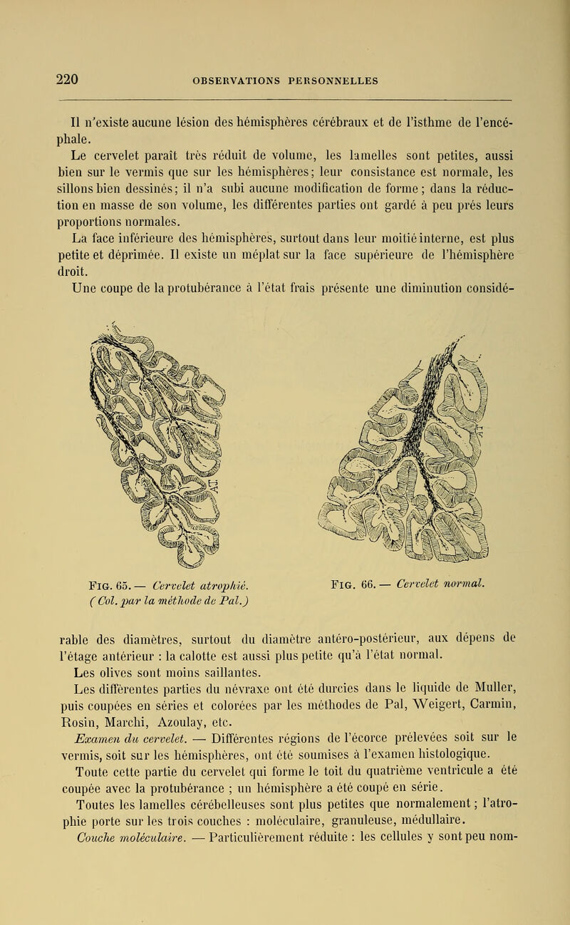 Il n'existe aucune lésion des hémisphères cérébraux et de l'isthme de l'encé- phale. Le cervelet paraît très réduit de volume, les lamelles sont petites, aussi bien sur le vermis que sur les hémisphères; leur consistance est normale, les sillons bien dessinés ; il n'a subi aucune modification de forme ; dans la réduc- tion en masse de son volume, les difTérentes parties ont gardé à peu prés leurs proportions normales. La face inférieure des hémisphères, surtout dans leur moitié interne, est plus petite et déprimée. Il existe un méplat sur la face supérieure de l'hémisphère droit. Une coupe de la protubérance à l'état frais présente une diminution considé- FlG. 65. — Cervelet atrophié. ( Col. par la métliode de Pal.) FiG. 66. — Cervelet normal. rable des diamètres, surtout du diamètre antéro-postérieur, aux dépens de l'étage antérieur : la calotte est aussi plus petite qu'à l'état normal. Les olives sont moins saillantes. Les différentes parties du névraxe ont été durcies dans le liquide de Muller, puis coupées en séries et colorées par les méthodes de Pal, Weigert, Carmin, Rosin, Marchi, Azoulay, etc. Examen du cervelet. — Différentes régions de l'écorce prélevées soit sur le vermis, soit sur les hémisphères, ont été soumises à l'examen histologique. Toute cette partie du cervelet qui forme le toit du quatrième ventricule a été coupée avec la protubérance ; un hémisphère a été coupé en série. Toutes les lamelles cérébelleuses sont plus petites que normalement ; l'atro- phie porte sur les trois couches : moléculaire, granuleuse, médullaire. Couche moléculaire. — Particuhèrement réduite : les cellules y sont peu nom-