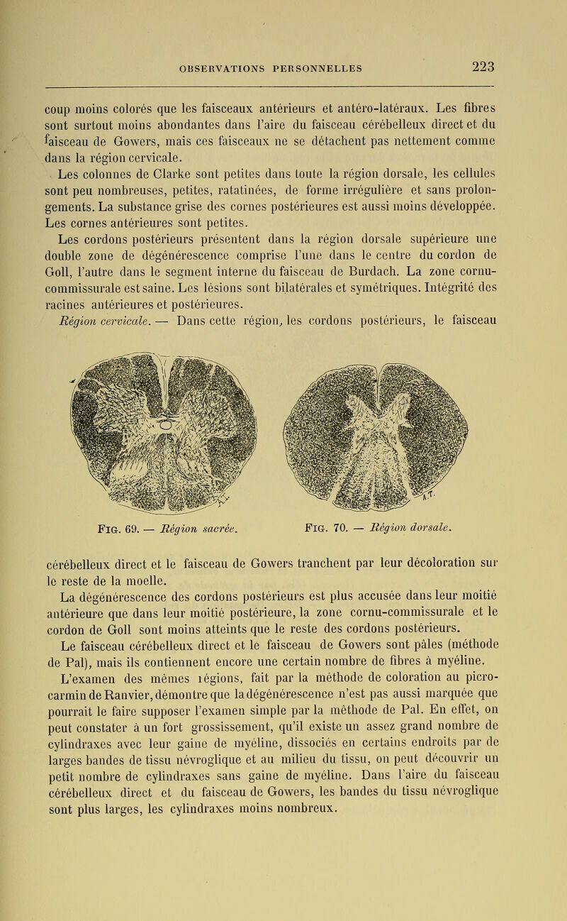 coup moins colorés que les faisceaux antérieurs et antéro-latéraux. Les fibres sont surtout moins abondantes dans l'aire du faisceau cérébelleux direct et du faisceau de Gowers, mais ces faisceaux ne se détachent pas nettement comme dans la région cervicale. Les colonnes de Olarke sont petites dans toute la région dorsale, les cellules sont peu nombreuses, petites, ratatinées, de forme irrégulière et sans prolon- gements, La substance grise des cornes postérieures est aussi moins développée. Les cornes antérieures sont petites. Les cordons postérieurs présentent dans la région dorsale supérieure une double zone de dégénérescence comprise l'une dans le centre du cordon de Goll, l'auti-e dans le segment interne du faisceau de Burdach. La zone cornu- commissurale est saine. Les lésions sont bilatérales et symétriques. Intégrité des racines antérieures et postérieures. Région cervicale. — Dans cette région, les cordons postérieurs, le faisceau FiG. 69. — Région sacrée. FiG. 70. — Région dorsale. cérébelleux direct et le faisceau de Gowers tranchent par leur décoloration sur le reste de la moelle. La dégénérescence des cordons postérieurs est plus accusée dans leur moitié antérieure que dans leur moitié postérieure, la zone cornu-commissurale et le cordon de Goll sont moins atteints que le reste des cordons postérieurs. Le faisceau cérébelleux direct et le faisceau de Gowers sont pâles (méthode de Pal), mais ils contiennent encore une certain nombre de fibres à myéline. L'examen des mêmes légions, fait par la méthode de coloration au picro- carmin de Ranvier, démontre que la dégénérescence n'est pas aussi marquée que pourrait le faire supposer l'examen simple par la méthode de Pal. En effet, on peut constater à un fort grossissement, qu'il existe un assez grand nombre de cylindraxes avec leur gaine de myéline, dissociés en certains endroits par de larges bandes de tissu névroglique et au milieu du tissu, on peut découvrir un petit nombre de cylindraxes sans gaine de myéline. Dans l'aire du faisceau cérébelleux direct et du faisceau de Gowers, les bandes du tissu névroglique sont plus larges, les cylindraxes moins nombreux.