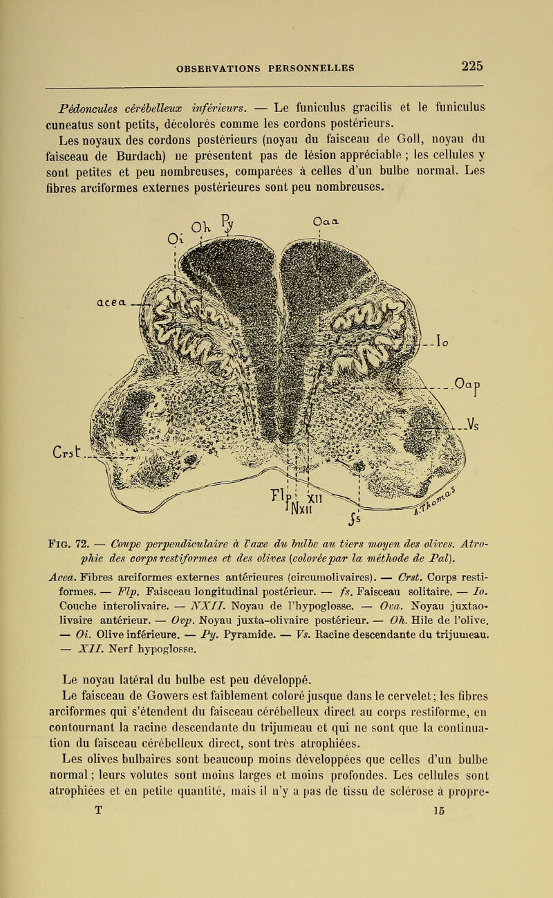 Pédoncules cérébelleux inférieurs. — Le funiculus gracilis et le funiculus cuneatus sont petits, décolorés comme les cordons postérieurs. Les noyaux des cordons postérieurs (noyau du faisceau de GoU, noyau du faisceau de Burdach) ne présentent pas de lésion appréciable ; les cellules y sont petites et peu nombreuses, comparées à celles d'un bulbe normal. Les fibres arciformes externes postérieures sont peu nombreuses. Cr5t..t%.i.. FiG. 72. — Coupe perpendiculaire à Vaxe du hulhe au tiers moyen des olives. Atro- phie des corps restifor mes et des olives (colorée par la méthode de Pal). Acea. Fibres arciformes externes antérieures (circumolivaires). — Crst. Corps resti- formes. — Flp. Faisceau longitudinal postérieur. — fs. Faisceau solitaire. — lo. Couche interolivaire. — NXII. Noyau de l'hypoglosse. — Ova. Noyau juxtao- livaire antérieur. — Ovp. Noyau juxta-olivaire postérieur. — Oh. Hile de l'olive. — Oi. Olive inférieure. — Py. Pyramide. — Vs. Kacine descendante du trijumeau. — XII. Nerf hypoglosse. Le noyau latéral du bulbe est peu développé. Le faisceau de Gowers est faiblement coloré jusque dans le cervelet; les fibres arciformes qui s'étendent du faisceau cérébelleux direct au corps restiforme, en contournant la racine descendante du trijumeau et qui ne sont que la continua- tion du faisceau cérébelleux direct, sont très atrophiées. Les olives bulbaires sont beaucoup moins développées que celles d'un bulbe normal ; leurs volutes sont moins larges et moins profondes. Les cellules sont atrophiées et en petite quantité, mais il n'y a pas de tissu de sclérose à proprc- T 16