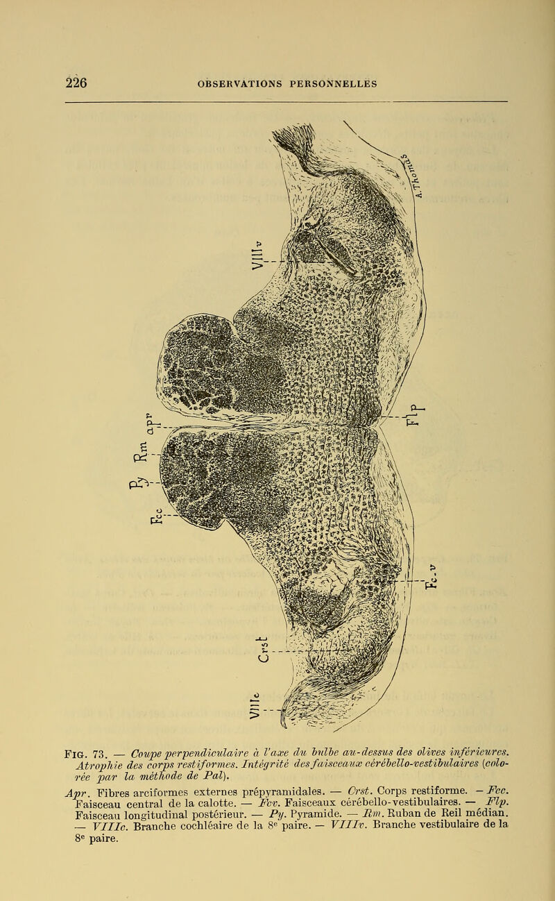 pr^-' FiG. 73. — Coupe perpendiculaift'e à l'axe du iidhe au-dessus des olives inférieures. Atrophie des corps restiformes. Intégrité des faisceaux céréiello-vestilulaires [colo- rée par la méthode de Pal). Apr. Fibres arciformes externes prépyramidales. — Crst. Corps restiforme. - Fcc. Faisceau central de la calotte. — Fcv. Faisceaux cérébello-vestibulaires. — Flp. Faisceau longitudinal postérieur. — Py. Pyramide. — Rm. Ruban de Reil médian. _ Ville. Branche cochléaire de la 8«'paire. — VIIIv. Branche vestibulaire de la 8« paire.