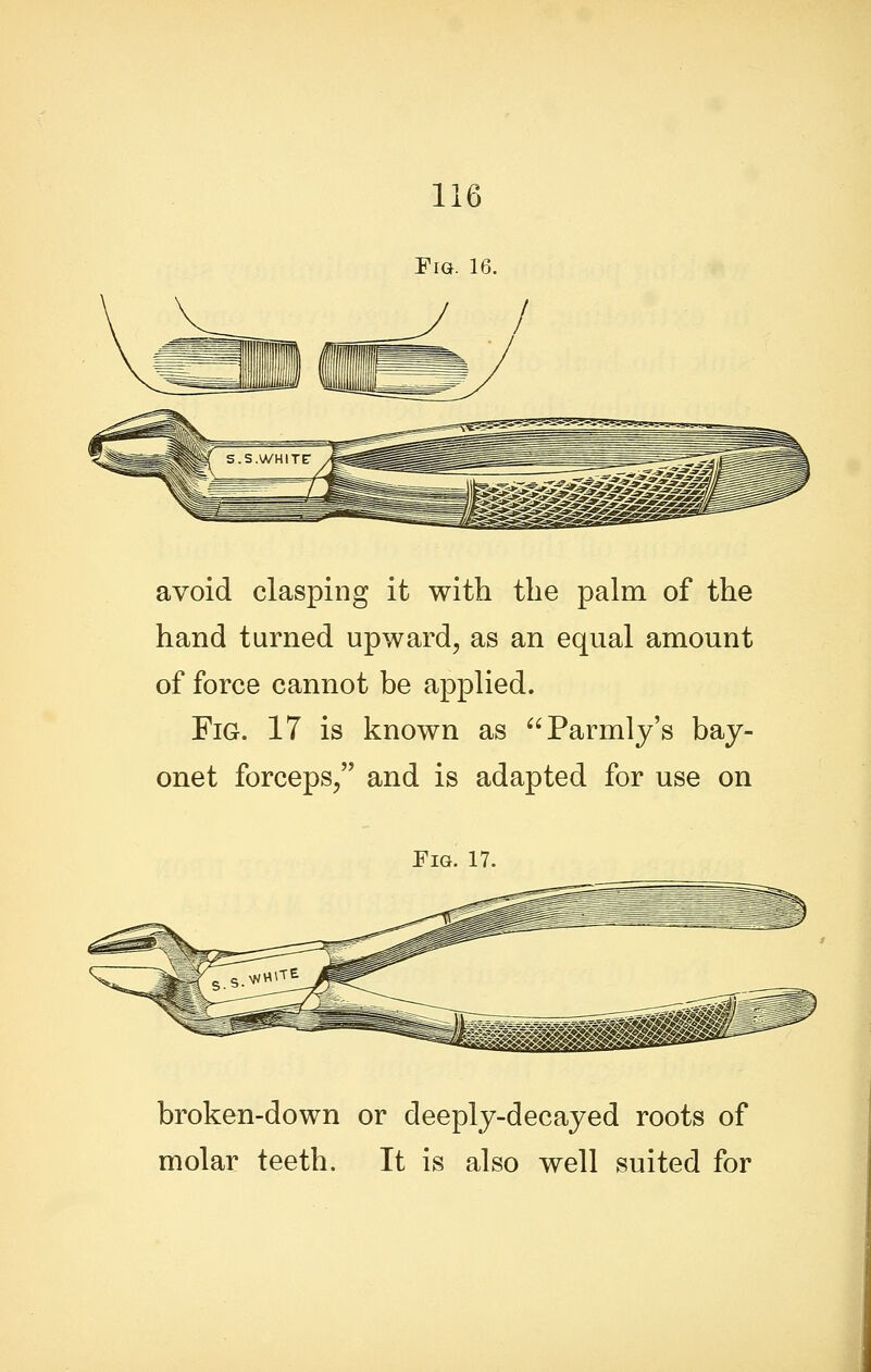 Fig. 16. avoid clasping it with the palm of the hand turned upward, as an equal amount of force cannot be applied. Fig. 17 is known as Parmly's bay- onet forceps/' and is adapted for use on Fig. 17. broken-down or deeply-decayed roots of molar teeth. It is also well suited for