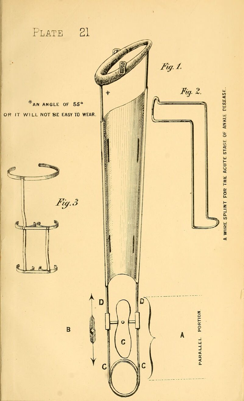 ^^AN ANGLE OF 5S° OR IT Wl LL NOT BE EASY TO WEAR Fi^.3