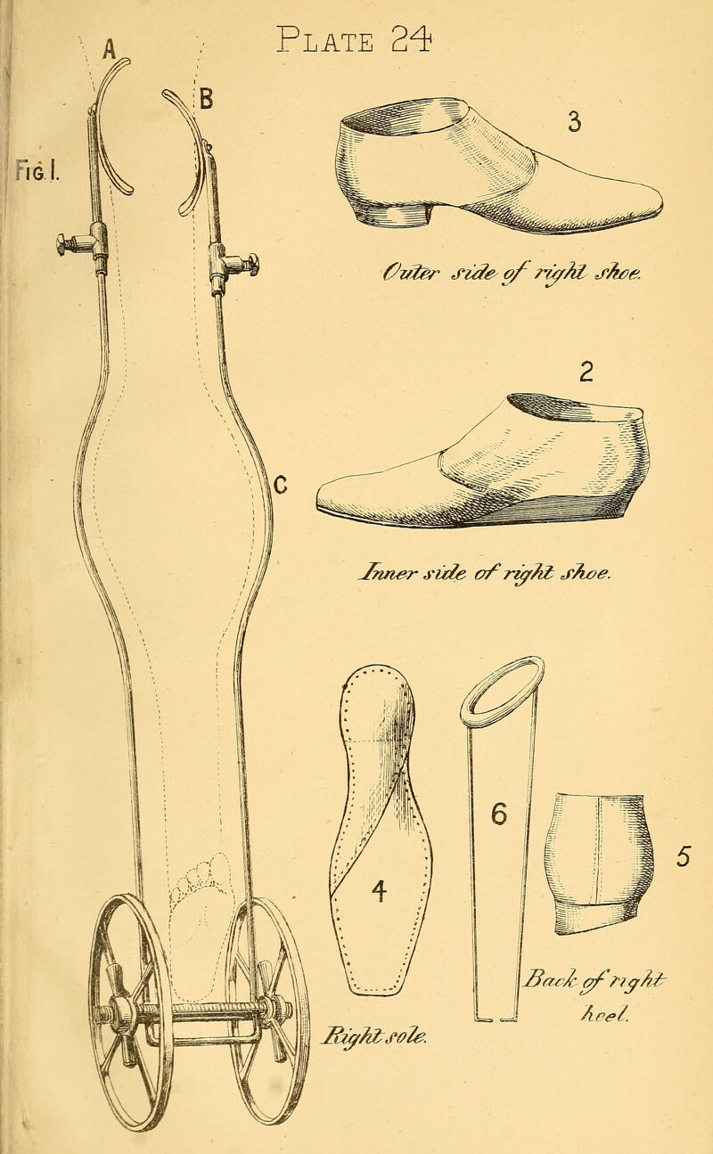 Fig. I. C^if^er J'i^e^o/^ r^?it j'Tt^e. Jnner side ofr^Td^ sTwe. ^of?^ ofy!^^