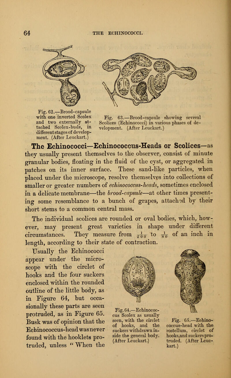 Fig. 62.—Brood-capsule ■with one inverted Scolex and two externally at- tached Scolex-buds, in different stages of develop- ment. (After Leuckart.) Fig. 63.—Brood-capsule shewing several Scolices (Echinococci) in various phases of de - velopment. (After Leuckart.) The Echinococci—Echinococcus-Heads or Scolices—as they usually present themselves to the observer, consist of minute granular bodies, floating in the fluid of the cyst, or aggregated in patches on its inner surface. These sand-like particles, when placed under the microscope, resolve themselves into collections of smaller or greater numbers of echinococcus-heads, sometimes enclosed in a delicate membrane—the brood-capsule—at other times present- ing some resemblance to a bunch of grapes, attached by their short stems to a common central mass. The individual scolices are rounded or oval bodies, which, how- ever, may present great varieties in shape under different circumstances. They measure from ^io *° To °f an mcn ^n length, according to their state of contraction. Usually the Echinococci appear under the micro- scope with the circlet of hooks and the four suckers enclosed within the rounded outline of the little body, as in Figure 64, but occa- sionally these parts are seen protruded, as in Figure 65. C1 Busk was Of opinion that the seen, with the circlet Fig. 6o-Eohino- 1 of hooks, and the coccus-head with the EcbinOCOCCUS-1 lead was never suckers withdrawn in- rostellum, circlet of found with the hooklets pro- f de the general body. hooks and suckerspro- r (After Leuckart.) traded. (After Leuc- truded, unless When the kart.)