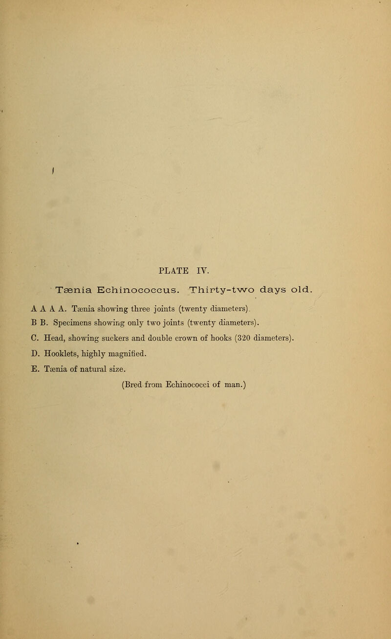 Taenia Echinococeus. Thirty-two days old. A A A. A. Taenia showing three joints (twenty diameters). B B. Specimens showing only two joints (twent3r diameters). C. Head, showing suckers and double crown of hooks (320 diameters). D. Hooklets, highly magnified. E. Taenia of natural size.