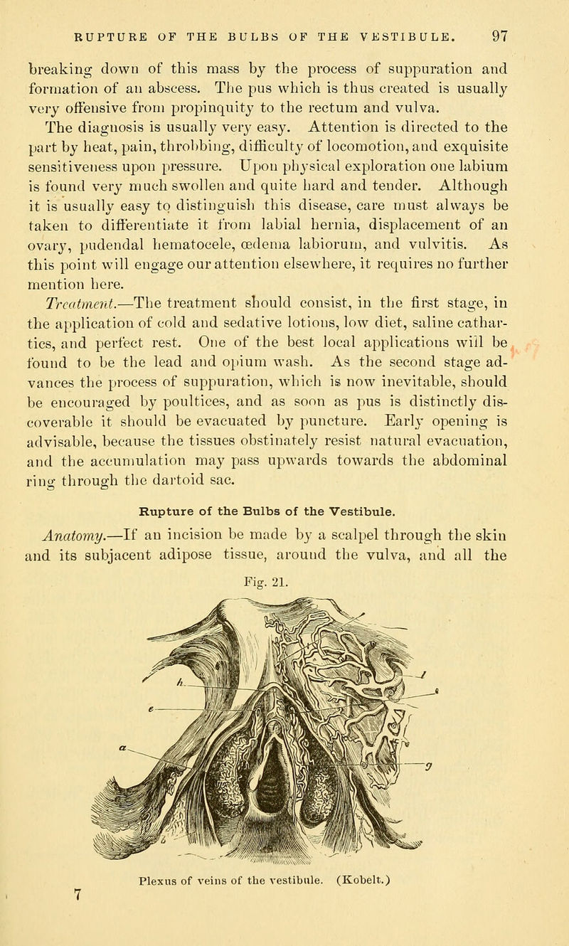 breaking down of this mass by the process of suppuration and formation of an abscess. The pus which is thus created is usually very offensive from propinquity to the rectum and vulva. The diagnosis is usually very easy. Attention is directed to the part by heat, pain, throbbing, difficulty of locomotion, and exquisite sensitiveness upon pressure. Upon physical exploration one labium is found very much swollen and quite hard and tender. Although it is usually easy to distinguish this disease, care must always be taken to differentiate it from labial hernia, displacement of an ovary, pudendal hematocele, oedema labiorum, and vulvitis. As this point will engage our attention elsewhere, it requires no further mention here. Treatment.—The treatment should consist, in the first stage, in the application of cold and sedative lotions, low diet, saline cathar- tics, and perfect rest. One of the best local applications will be found to be the lead and opium wash. As the second stage ad- vances the process of suppuration, which is now inevitable, should be encouraged by poultices, and as soon as pus is distinctly dis- coverable it should be evacuated by puncture. Early opening is advisable, because the tissues obstinately resist natural evacuation, and the accumulation may pass upwards towards the abdominal ring through the dartoid sac. Rupture of the Bulbs of the Vestibule. Anatomy.—If an incision be made by a scalpel through the skin and its subjacent adipose tissue, around the vulva, and all the Fig. 21. Plexus of veins of the vestibule. (Kobelt.)