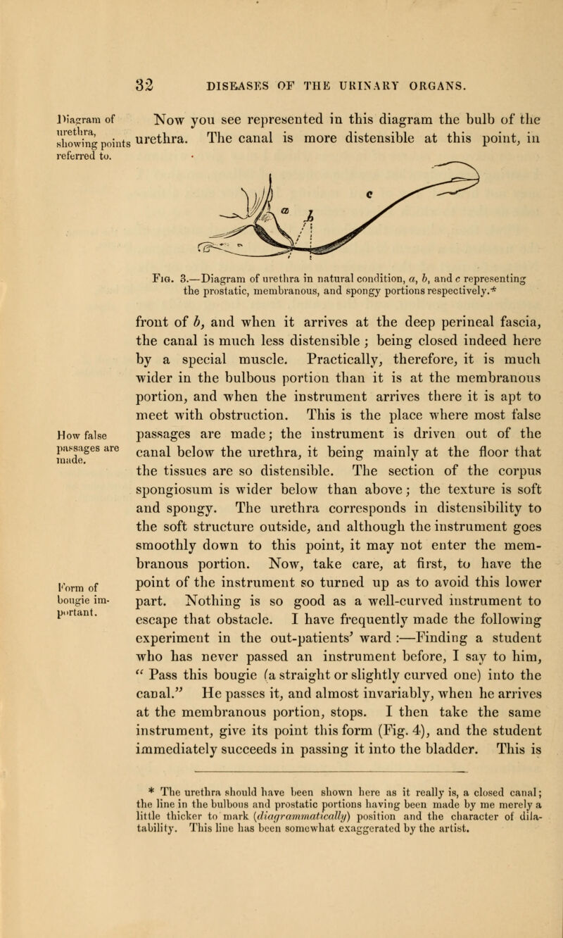 Diagram of urethra, showing points referred to. Now you see represented in this diagram the bulb of the urethra. The canal is more distensible at this point, in How false passages are made. Korm of bougie im- portant. Fig. rs^. 3.—Diagram of urethra in natural condition, a, b, and c representing the prostatic, membranous, and spongy portions respectively.* front of b, and when it arrives at the deep perineal fascia, the canal is much less distensible ; being closed indeed here by a special muscle. Practically, therefore, it is much wider in the bulbous portion than it is at the membranous portion, and when the instrument arrives there it is apt to meet with obstruction. This is the place where most false passages are made; the instrument is driven out of the canal below the urethra, it being mainly at the floor that the tissues are so distensible. The section of the corpus spongiosum is wider below than above; the texture is soft and spongy. The urethra corresponds in distensibility to the soft structure outside, and although the instrument goes smoothly down to this point, it may not enter the mem- branous portion. Now, take care, at first, to have the point of the instrument so turned up as to avoid this lower part. Nothing is so good as a well-curved instrument to escape that obstacle. I have frequently made the following experiment in the out-patients' ward :—Finding a student who has never passed an instrument before, I say to him,  Pass this bougie (a straight or slightly curved one) into the canal. He passes it, and almost invariably, when he arrives at the membranous portion, stops. I then take the same instrument, give its point this form (Fig. 4), and the student immediately succeeds in passing it into the bladder. This is * The urethra should have been shown here as it really is, a closed canal; the line in the bulbous and prostatic portions having been made by me merely a little thicker to mark {dietgrammatically) position and the character of dila- tability. This line has been somewhat exaggerated by the artist.