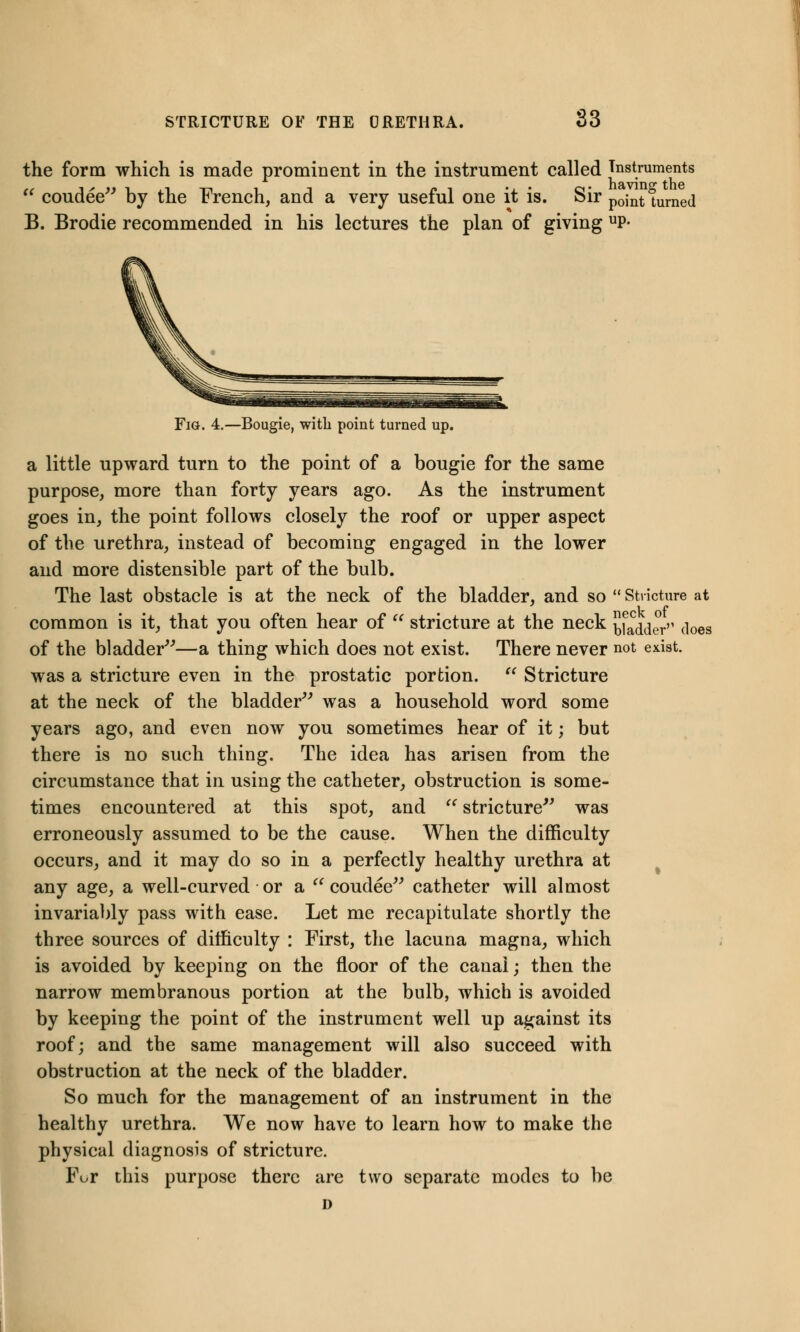 the form which is made prominent in the instrument called Instruments  coudee by the French, and a very useful one it is. Sir pojnt turned B. Brodie recommended in his lectures the plan of giving UP- Fig. 4.—Bougie, with point turned up. a little upward turn to the point of a bougie for the same purpose, more than forty years ago. As the instrument goes in, the point follows closely the roof or upper aspect of the urethra, instead of becoming engaged in the lower and more distensible part of the bulb. The last obstacle is at the neck of the bladder, and so  Stricture at common is it, that you often hear of  stricture at the neck ladder does of the bladder—a thing which does not exist. There never not exist. was a stricture even in the prostatic portion.  Stricture at the neck of the bladder was a household word some years ago, and even now you sometimes hear of it; but there is no such thing. The idea has arisen from the circumstance that in using the catheter, obstruction is some- times encountered at this spot, and  stricture was erroneously assumed to be the cause. When the difficulty occurs, and it may do so in a perfectly healthy urethra at any age, a well-curved or a  coudee catheter will almost invariably pass with ease. Let me recapitulate shortly the three sources of difficulty : First, the lacuna magna, which is avoided by keeping on the floor of the canal; then the narrow membranous portion at the bulb, which is avoided by keeping the point of the instrument well up against its roof; and the same management will also succeed with obstruction at the neck of the bladder. So much for the management of an instrument in the healthy urethra. We now have to learn how to make the physical diagnosis of stricture. For this purpose there are two separate modes to be D