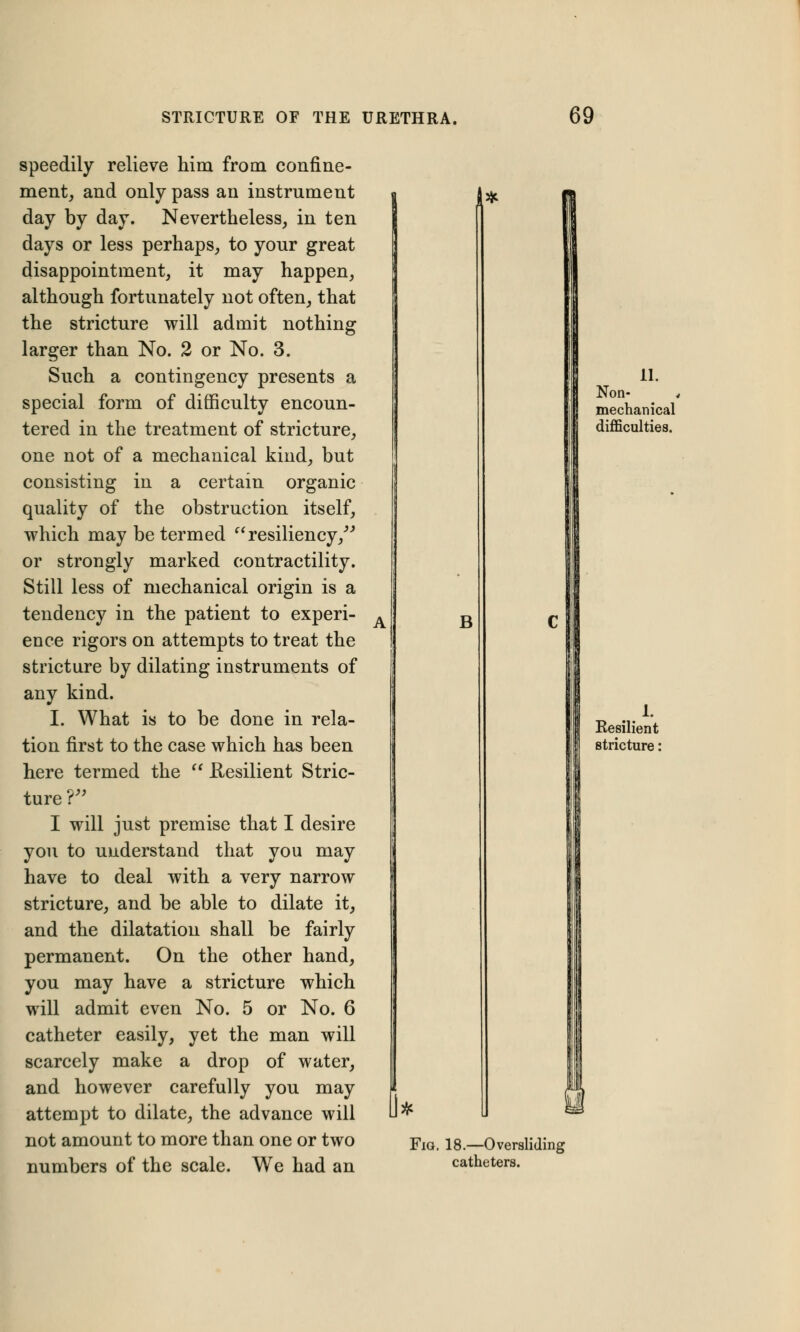 speedily relieve him from confine- ment, and only pass an instrument day by day. Nevertheless, in ten days or less perhaps, to your great disappointment, it may happen, although fortunately not often, that the stricture will admit nothing larger than No. 2 or No. 3. Such a contingency presents a special form of difficulty encoun- tered in the treatment of stricture, one not of a mechanical kind, but consisting in a certain organic quality of the obstruction itself, which may be termed  resiliency/'' or strongly marked contractility. Still less of mechanical origin is a tendency in the patient to experi- ence rigors on attempts to treat the stricture by dilating instruments of any kind. I. What is to be done in rela- tion first to the case which has been here termed the  Resilient Stric- ture i I will just premise that I desire yon to understand that you may have to deal with a very narrow stricture, and be able to dilate it, and the dilatation shall be fairly permanent. On the other hand, you may have a stricture which will admit even No. 5 or No. 6 catheter easily, yet the man will scarcely make a drop of water, and however carefully you may attempt to dilate, the advance will not amount to more than one or two numbers of the scale. We had an B 0* 11. Non- 4 mechanical difficulties. 1. Resilient stricture: Fig. 18.—Oversliding catheters.