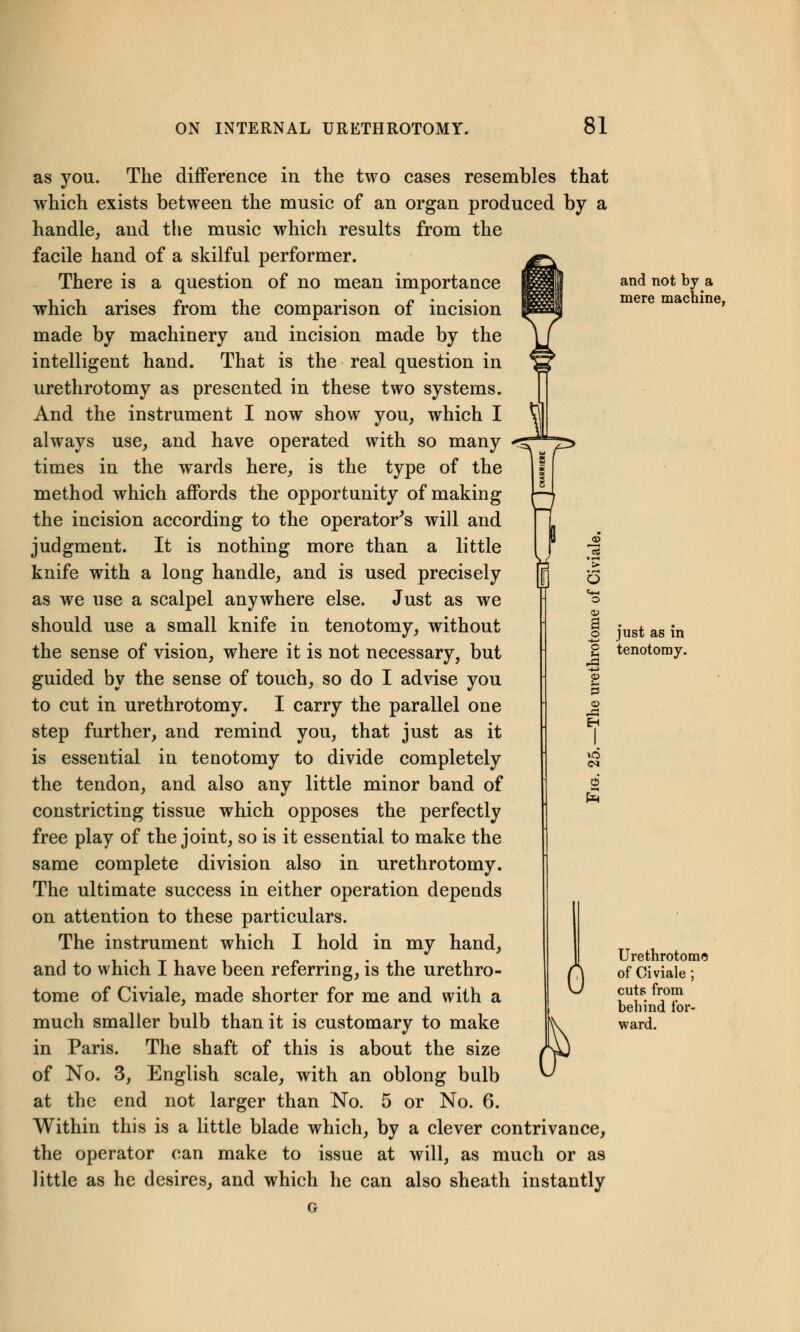 <^7r> as you. The difference in the two cases resembles that which exists between the music of an organ produced by a handle, and the music which results from the facile hand of a skilful performer. There is a question of no mean importance which arises from the comparison of incision made by machinery and incision made by the intelligent hand. That is the real question in urethrotomy as presented in these two systems. And the instrument I now show you, which I always use, and have operated with so many times in the wards here, is the type of the method which affords the opportunity of making the incision according to the operator's will and judgment. It is nothing more than a little knife with a long handle, and is used precisely as we use a scalpel anywhere else. Just as we should use a small knife in tenotomy, without the sense of vision, where it is not necessary, but guided by the sense of touch, so do I advise you to cut in urethrotomy. I carry the parallel one step further, and remind you, that just as it is essential in tenotomy to divide completely the tendon, and also any little minor band of constricting tissue which opposes the perfectly free play of the joint, so is it essential to make the same complete division also in urethrotomy. The ultimate success in either operation depends on attention to these particulars. The instrument which I hold in my hand, and to which I have been referring, is the urethro- tome of Civiale, made shorter for me and with a much smaller bulb than it is customary to make in Paris. The shaft of this is about the size of No. 3, English scale, with an oblong bulb at the end not larger than No. 5 or No. 6. Within this is a little blade which, by a clever contrivance, the operator can make to issue at will, as much or as little as he desires, and which he can also sheath instantly • <-* > o <1> a o -4—* C U p £ E-t 6 0 and not by a mere machine, just as in tenotomy. Urethrotome of Civiale; cuts from behind for- ward.