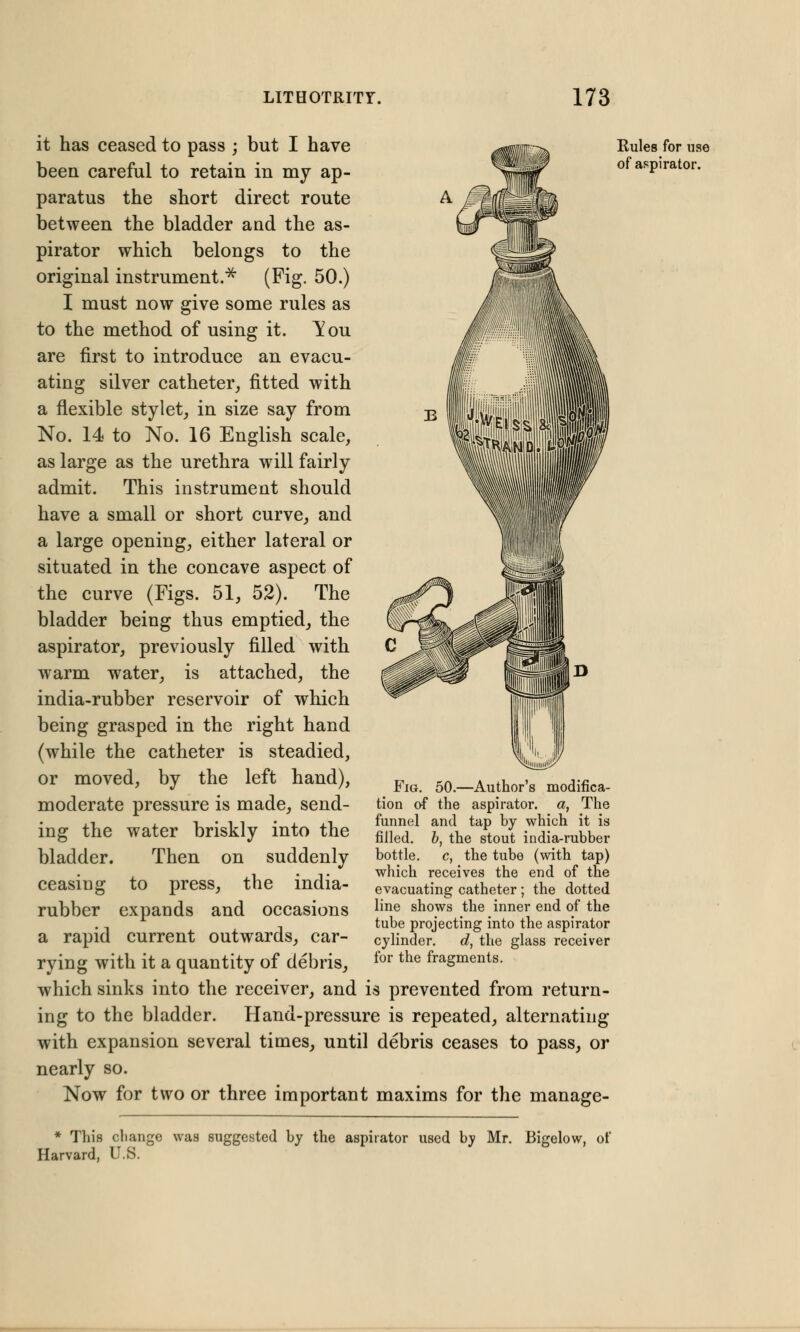 it has ceased to pass ; but I have been careful to retain in my ap- paratus the short direct route between the bladder and the as- pirator which belongs to the original instrument.* (Fig. 50.) I must now give some rules as to the method of using it. Tou are first to introduce an evacu- ating silver catheter, fitted with a flexible stylet, in size say from No. 14 to No. 16 English scale, as large as the urethra will fairly admit. This instrument should have a small or short curve, and a large opening, either lateral or situated in the concave aspect of the curve (Figs. 51, 52). The bladder being thus emptied, the aspirator, previously filled with warm water, is attached, the india-rubber reservoir of which being grasped in the right hand (while the catheter is steadied, or moved, by the left hand), moderate pressure is made, send- ing the water briskly into the bladder. Then on suddenly ceasing to press, the india- rubber expands and occasions a rapid current outwards, car- rying with it a quantity of debris, which sinks into the receiver, and is prevented from return- ing to the bladder. Hand-pressure is repeated, alternating with expansion several times, until debris ceases to pass, or nearly so. Now for two or three important maxims for the manage- Rules for use of aspirator. Fig. 50.—Author's modifica- tion of the aspirator, a, The funnel and tap by which it is filled, b, the stout india-rubber bottle, c, the tube (with tap) which receives the end of the evacuating catheter ; the dotted line shows the inner end of the tube projecting into the aspirator cylinder. d, the glass receiver for the fragments. * This change was suggested by the aspirator used by Mr. Bigelow, of Harvard, U.S.