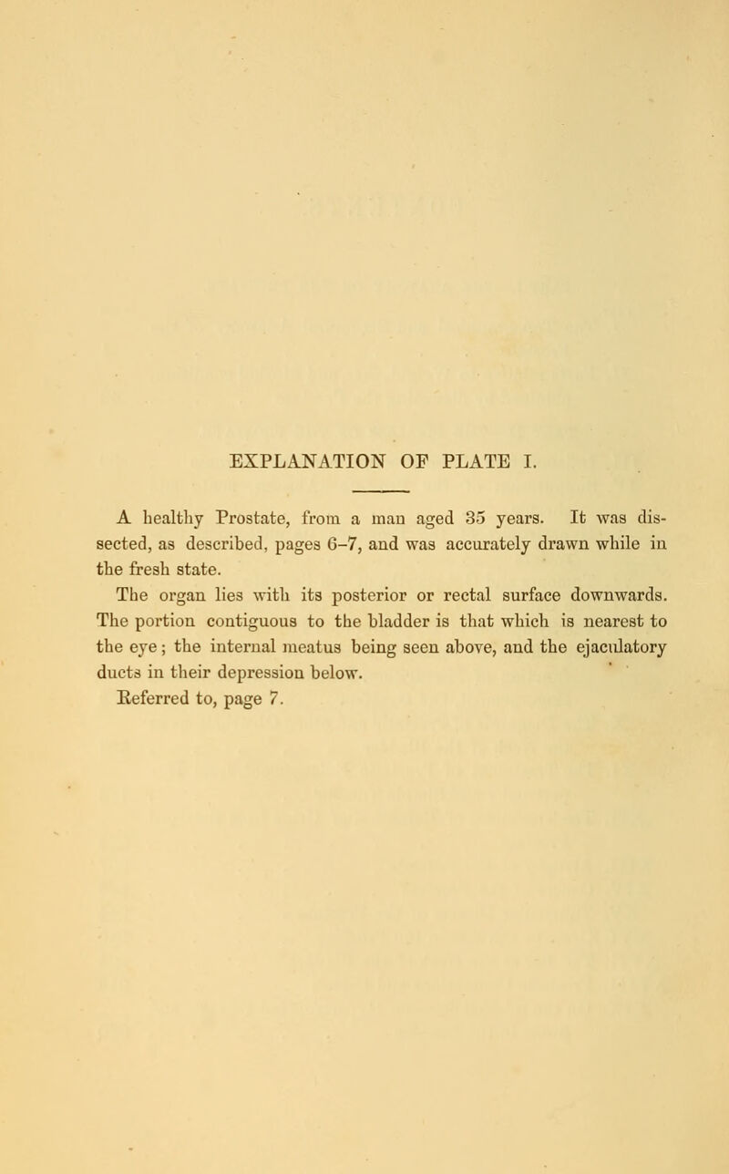 A healthy Prostate, from a man aged 35 years. It was dis- sected, as described, pages 6-7, and was accurately drawn while in the fresh state. The organ lies with its posterior or rectal surface downwards. The portion contiguous to the bladder is that which is nearest to the eye; the internal meatus being seen above, and the ejaculatory ducts in their depression below. Referred to, page 7.