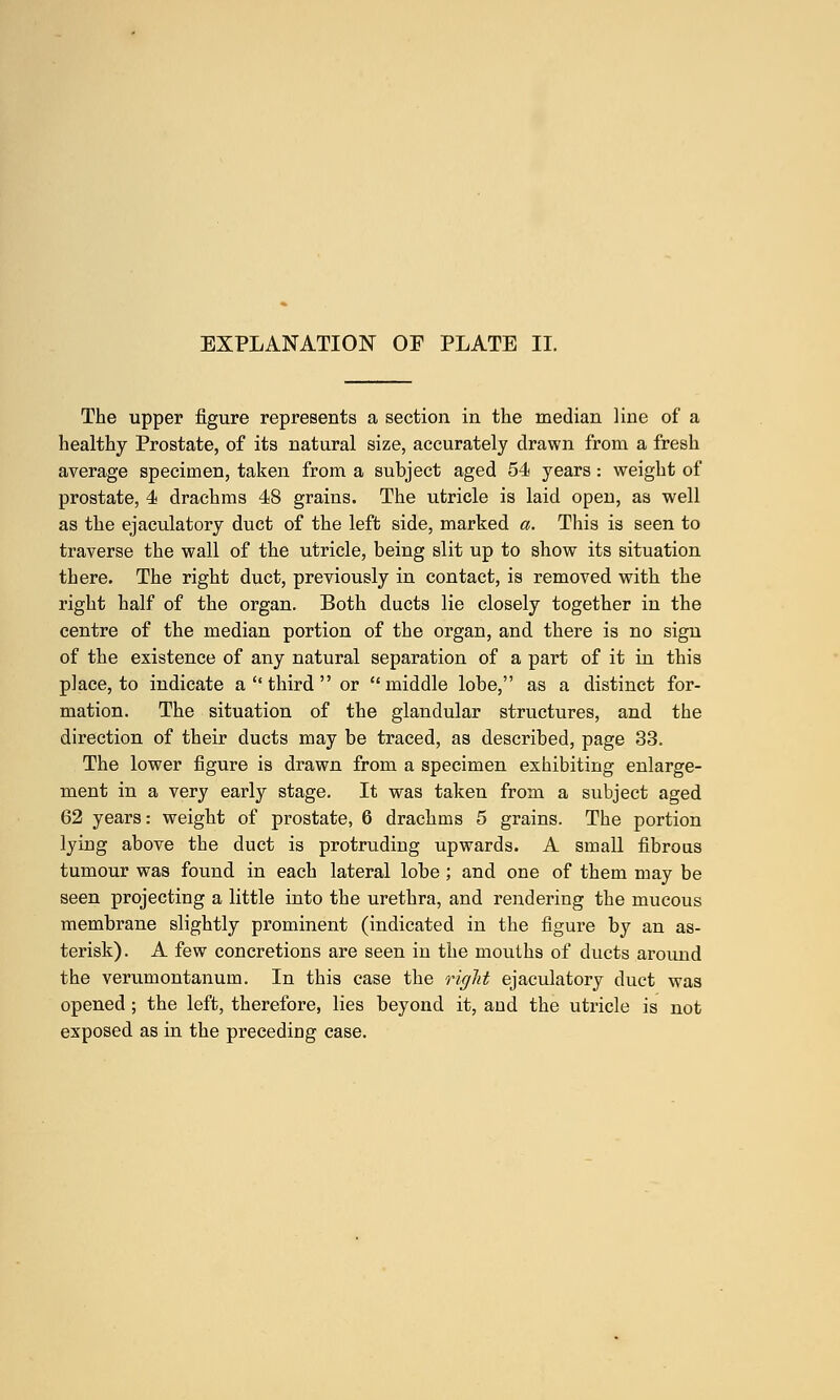 The upper figure represents a section in the median line of a healthy Prostate, of its natural size, accurately drawn from a fresh average specimen, taken from a subject aged 54 years : weight of prostate, 4 drachms 48 grains. The utricle is laid open, as well as the ejaculatory duct of the left side, marked a. This is seen to traverse the wall of the utricle, being slit up to show its situation there. The right duct, previously in contact, is removed with the right half of the organ. Both ducts lie closely together in the centre of the median portion of the organ, and there is no sign of the existence of any natural separation of a part of it in this place, to indicate a  third  or middle lobe, as a distinct for- mation. The situation of the glandular structures, and the direction of their ducts may be traced, as described, page 33. The lower figure is drawn from a specimen exhibiting enlarge- ment in a very early stage. It was taken from a subject aged 62 years: weight of prostate, 6 drachms 5 grains. The portion lying above the duct is protruding upwards. A small fibrous tumour was found in each lateral lobe ; and one of them may be seen projecting a little into the urethra, and rendering the mucous membrane slightly prominent (indicated in the figure by an as- terisk). A few concretions are seen in the mouths of ducts around the verumontanum. In this case the right ejaculatory duct was opened ; the left, therefore, lies beyond it, and the utricle is not exposed as in the preceding case.