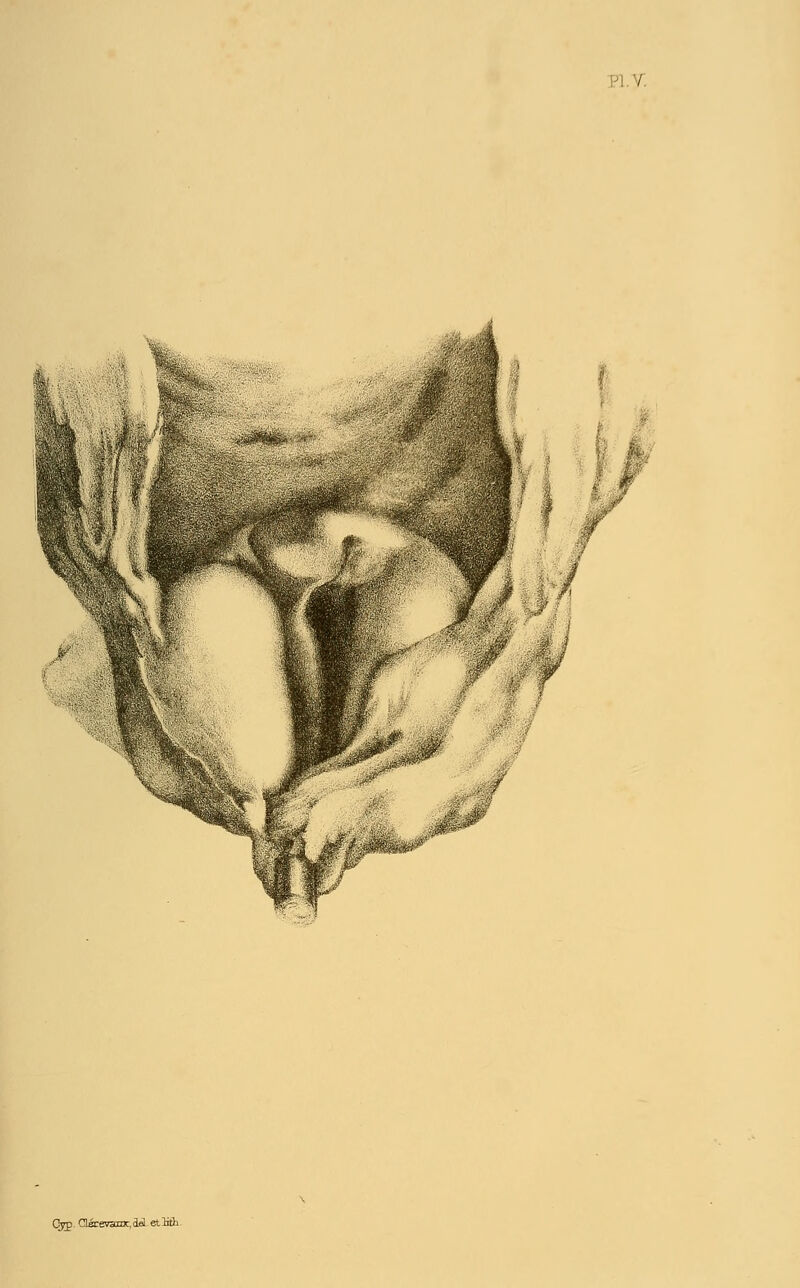 / Cj3>. Osrevanx.dol -etlith.