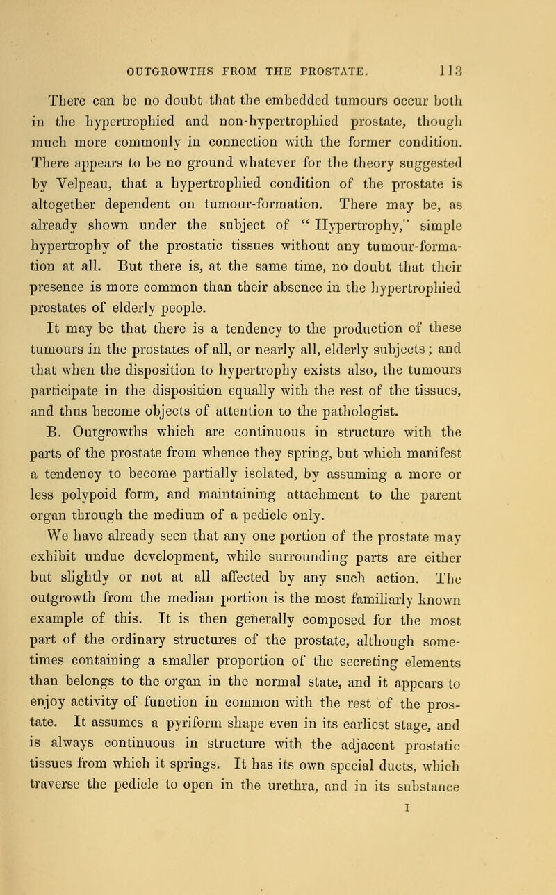 There can be no doubt that the embedded tumours occur both in the hypertrophied and non-hypertrophied prostate, though much more commonly in connection with the former condition. There appears to be no ground whatever for the theory suggested by Velpeau, that a hypertrophied condition of the prostate is altogether dependent on tumour-formation. There may be, as already shown under the subject of  Hypertrophy, simple hypertrophy of the prostatic tissues without any tumour-forma- tion at all. But there is, at the same time, no doubt that their presence is more common than their absence in the hypertrophied prostates of elderly people. It may be that there is a tendency to the production of these tumours in the prostates of all, or nearly all, elderly subjects; and that when the disposition to hypertrophy exists also, the tumours participate in the disposition equally with the rest of the tissues, and thus become objects of attention to the pathologist. B. Outgrowths which are continuous in structure with the parts of the prostate from whence they spring, but which manifest a tendency to become partially isolated, by assuming a more or less polypoid form, and maintaining attachment to the parent organ through the medium of a pedicle only. We have already seen that any one portion of the prostate may exhibit undue development, while surrounding parts are either but slightly or not at all affected by any such action. The outgrowth from the median portion is the most familiarly known example of this. It is then generally composed for the most part of the ordinary structures of the prostate, although some- times containing a smaller proportion of the secreting elements than belongs to the organ in the normal state, and it appears to enjoy activity of function in common with the rest of the pros- tate. It assumes a pyriform shape even in its earliest stage, and is always continuous in structure with the adjacent prostatic tissues from which it springs. It has its own special ducts, which traverse the pedicle to open in the urethra, and in its substance i