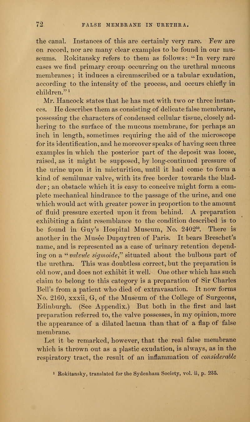 the canal. Instances of this are certainly very rare. Few are on record, nor are many clear examples to be found in our mu- seums. Eokitansky refers to them as follows: In very rare cases we find primary croup occurring on the urethral mucous membranes; it induces a circumscribed or a tabular exudation, according to the intensity of the process, and occurs chiefly in children.* Mr. Hancock states that he has met with two or three instan- ces. He describes them as consisting of delicate false membrane, possessing the characters of condensed cellular tissue, closely ad- hering to the surface of the mucous membrane, for perhaps an inch in length, sometimes requiring the aid of the microscope for its identification, and he moreover speaks of having seen three examples in which the posterior part of the deposit was loose, raised, as it might be supposed, by long-continued pressure of the urine upon it in micturition, until it had come to form a kind of semilunar valve, with its free border towards the blad- der ; an obstacle which it is easy to conceive might form a com- plete mechanical hindrance to the passage of the urine, and one which would act with greater power in proportion to the amount of fluid pressure exerted upon it from behind. A preparation exhibiting: a faint resemblance to the condition described is to be found in Guy's Hospital Museum, No. 240210. There is another in the Musee Dupuytren of Paris. It bears Breschet's name, and is represented as a case of urinary retention depend- ing on a  valvule sigmoide situated about the bulbous part of the urethra. This was doubtless correct, but the preparation is old now, and does not exhibit it well. One other which has such claim to belong to this category is a preparation of Sir Charles Bell's from a patient who died of extravasation. It now forms No. 2160, xxxii, G, of the Museum of the College of Surgeons, Edinburgh. (See Appendix.) But both in the first and last preparation referred to, the valve possesses, in my opinion, more the appearance of a dilated lacuna than that of a flap of false membrane. Let it be remarked, however, that the real false membrane which is thrown out as a plastic exudation, is always, as in the respiratory tract, the result of an inflammation of considerable 1 Eokitansky, translated for the Sydenham Society, vol. ii, p. 235.