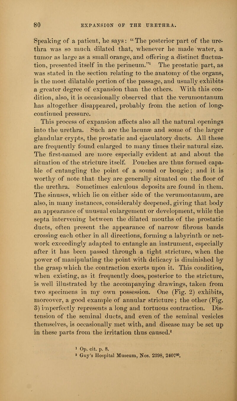 Speaking of a patient, Tie says:  The posterior part of the ure- thra was so much dilated that, whenever he made water, a tumor as large as a small orange, and offering a distinct fluctua- tion, presented itself in the perineum.1 The prostatic part, as was stated in the section relating to the anatomy of the organs, is the most dilatable portion of the passage, and usually exhibits a greater degree of expansion than the others. With this con- dition, also, it is occasionally observed that the verumontanum has altogether disappeared, probably from the action of long- continued pressure. This process of expansion affects also all the natural openings into the urethra. Such are the lacunae and some of the larger glandular crypts, the prostatic and ejaculatory ducts. All these are frequently found enlarged to many times their natural size. The first-named are more especially evident at and about the situation of the stricture itself. Pouches are thus formed capa- ble of entangling the point of a sound or bougie; and it is worthy of note that they are generally situated on the floor of the urethra. Sometimes calculous deposits are found in them. The sinuses, which lie on either side of the verumontanum, are also, in many instances, considerably deepened, giving that body an appearance of unusual enlargement or development, while the septa intervening between the dilated mouths of the prostatic ducts, often present the appearance of narrow fibrous bands crossing each other in all directions, forming a labyrinth or net- work exceedingly adapted to entangle an instrument, especially after it has been passed through a tight stricture, when the power of manipulating the point with delicacy is diminished by the grasp which the contraction exerts upon it. This condition, when existing, as it frequently does, posterior to the stricture, is well illustrated by the accompanying drawings, taken from two specimens in my own possession. One (Fig. 2) exhibits, moreover, a good example of annular stricture; the other (Fig. 3) imperfectly represents a long and tortuous contraction. Dis- tension of the seminal ducts, and even of the seminal vesicles themselves, is occasionally met with, and disease may be set up in these parts from the irritation thus caused.2 1 Op. cit. p. 8. 2 Guy's Hospital Museum, Nos. 2398, 240750.