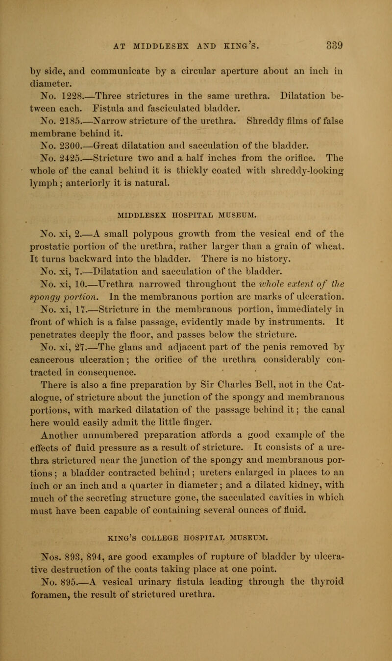 by side, and communicate by a circular aperture about an inch in diameter. No. 1228.—Three strictures in the same urethra. Dilatation be- tween each. Fistula and fasciculated bladder. No. 2185.—Narrow stricture of the urethra. Shreddy films of false membrane behind it. No. 2300.—Great dilatation and sacculation of the bladder. No. 2425.—Stricture two and a half inches from the orifice. The whole of the canal behind it is thickly coated with shreddy-looking lymph; anteriorly it is natural. MIDDLESEX HOSPITAL MUSEUM. No. xi, 2.—A small polypous growth from the vesical end of the prostatic portion of the urethra, rather larger than a grain of wheat. It turns backward into the bladder. There is no history. No. xi, 1 Dilatation and sacculation of the bladder. No. xi, 10.—Urethra narrowed throughout the whole extent of the spongy portion. In the membranous portion are marks of ulceration. No. xi, 11.—Stricture in the membranous portion, immediately in front of which is a false passage, evidently made by instruments. It penetrates deeply the floor, and passes below the stricture. No. xi, 21.—The glans and adjacent part of the penis removed by cancerous ulceration; the orifice of the urethra considerably con- tracted in consequence. There is also a fine preparation by Sir Charles Bell, not in the Cat- alogue, of stricture about the junction of the spongj^ and membranous portions, with marked dilatation of the passage behind it; the canal here would easily admit the little finger. Another unnumbered preparation affords a good example of the effects of fluid pressure as a result of stricture. It consists of a ure- thra strictured near the junction of the spongy and membranous por- tions ; a bladder contracted behind ; ureters enlarged in places to an inch or an inch and a quarter in diameter; and a dilated kidney, with much of the secreting structure gone, the sacculated cavities in which must have been capable of containing several ounces of fluid. king's college hospital museum. Nos. 893, 894, are good examples of rupture of bladder by ulcera- tive destruction of the coats taking place at one point. No. 895.—A vesical urinary fistula leading through the thyroid foramen, the result of strictured urethra.