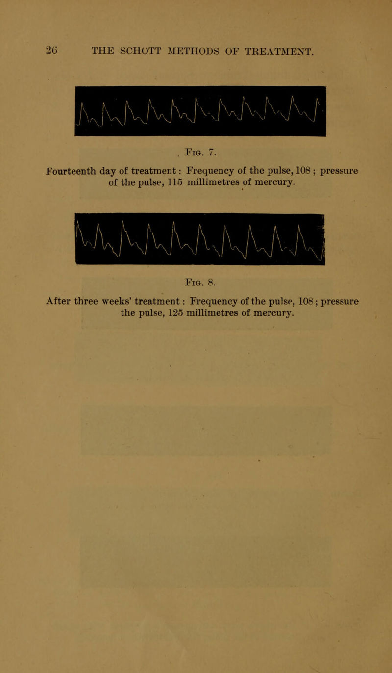 . Fig. 7. Fourteenth day of treatment: Frequency of the pulse, 108 ; pressure of the pulse, 115 millimetres of mercury. Fig. 8. After three weeks' treatment: Frequency of the pulse, 108; pressure the pulse, 125 millimetres of mercury.