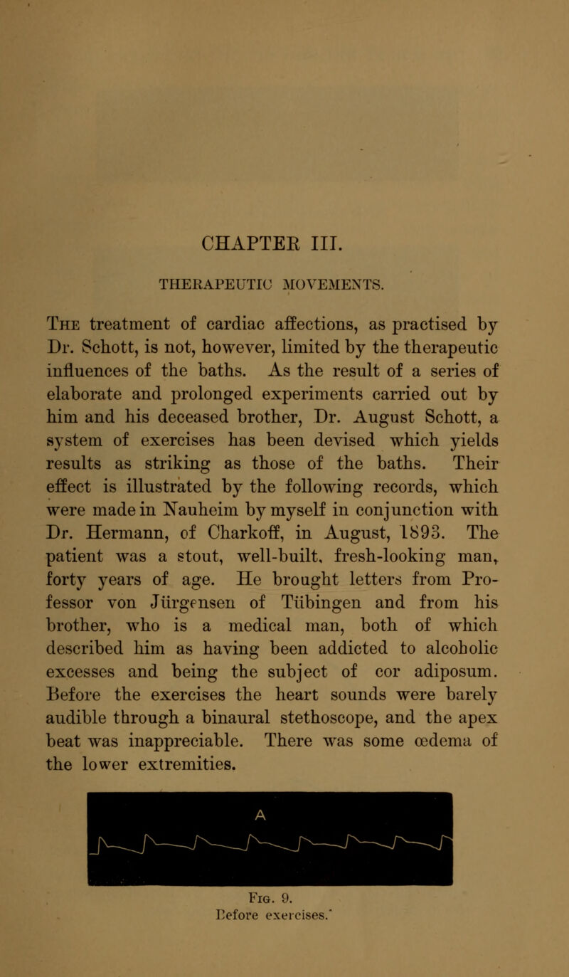 CHAPTEE III. THERAPEUTIC MOVEMENTS. The treatment of cardiac affections, as practised by Dr. Schott, is not, however, limited by the therapeutic influences of the baths. As the result of a series of elaborate and prolonged experiments carried out by him and his deceased brother, Dr. August Schott, a system of exercises has been devised which yields results as striking as those of the baths. Their effect is illustrated by the following records, which were made in Nauheim by myself in conjunction with Dr. Hermann, of Charkoff, in August, 1893. The patient was a stout, well-built, fresh-looking mant forty years of age. He brought letters from Pro- fessor von Jurgfnsen of Tubingen and from his brother, who is a medical man, both of which described him as having been addicted to alcoholic excesses and being the subject of cor adiposum. Before the exercises the heart sounds were barely audible through a binaural stethoscope, and the apex beat was inappreciable. There was some oedema of the lower extremities. Fig. 9. Eefore exercises.