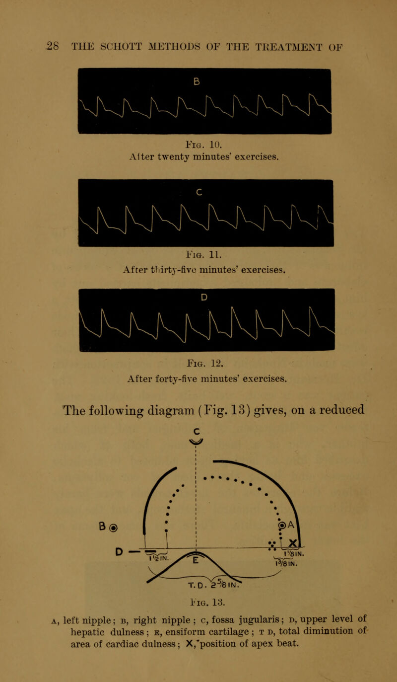 Fig. 10. Alter twenty minutes' exercises. Fig. 11. After tliirty-five minutes' exercises. Fig. 12. After forty-five minutes' exercises. The following diagram (Tig. 13) gives, on a reduced T.D. 25/8IN; Fig. 13. left nipple; b, right nipple ; c, fossa jugularis; d, upper level of hepatic dulness; e, ensiform cartilage ; t d, total diminution of area of cardiac dulness; X,position of apex beat.