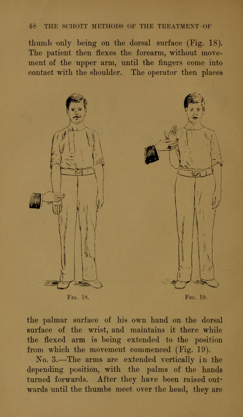 thumb only being on the dorsal surface (Fig. 18). The patient then flexes the forearm, without move- ment of the upper arm, until the fingers come into contact with the shoulder. The operator then places Fig. 18. Fig. 19. the palmar surface of his own hand on the dorsal surface of the wrist, and maintains it there while the flexed arm is being extended to the position from which the movement commenced (Fig. 19). No. 3.—The arms are extended vertically in the depending position, with the palms of the hands turned forwards. After they have been raised out- wards until the thumbs meet over the head, they are