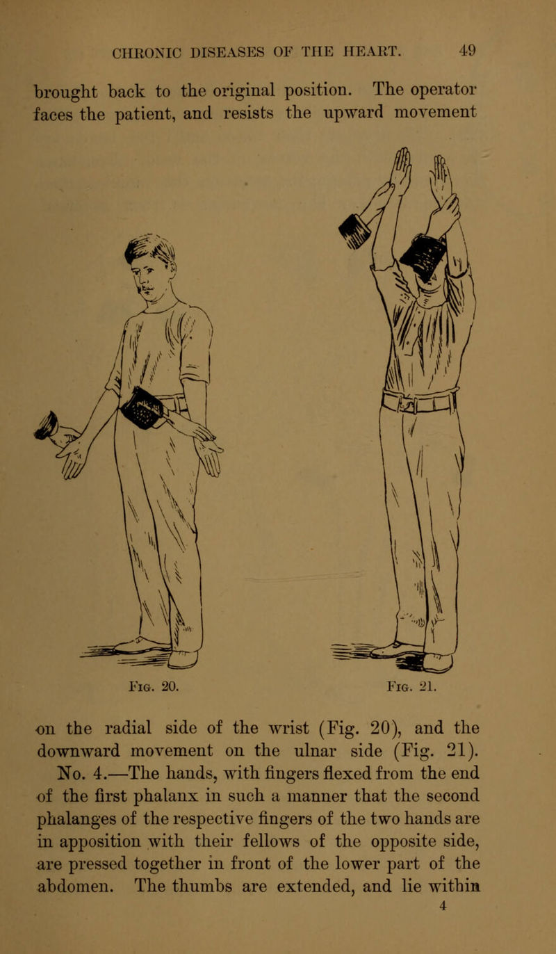brought back to the original position. The operator faces the patient, and resists the upward movement Fig. 20. Fig. 21. on the radial side of the wrist (Fig. 20), and the downward movement on the ulnar side (Fig. 21). No. 4.—The hands, with fingers flexed from the end of the first phalanx in such a manner that the second phalanges of the respective fingers of the two hands are in apposition with their fellows of the opposite side, are pressed together in front of the lower part of the abdomen. The thumbs are extended, and lie within 4