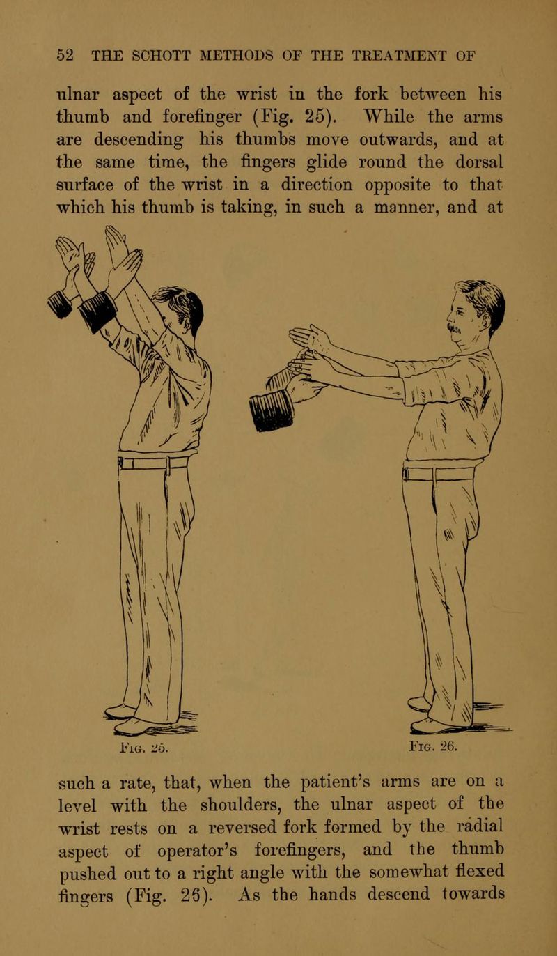 ulnar aspect of the wrist in the fork between his thumb and forefinger (Fig. 25). While the arms are descending his thumbs move outwards, and at the same time, the fingers glide round the dorsal surface of the wrist in a direction opposite to that which his thumb is taking, in such a manner, and at Fi(i. 2b. such a rate, that, when the patient's arms are on a level with the shoulders, the ulnar aspect of the wrist rests on a reversed fork formed by the radial aspect of operator's forefingers, and the thumb pushed out to a right angle with the somewhat flexed fingers (Fig. 26). As the hands descend towards