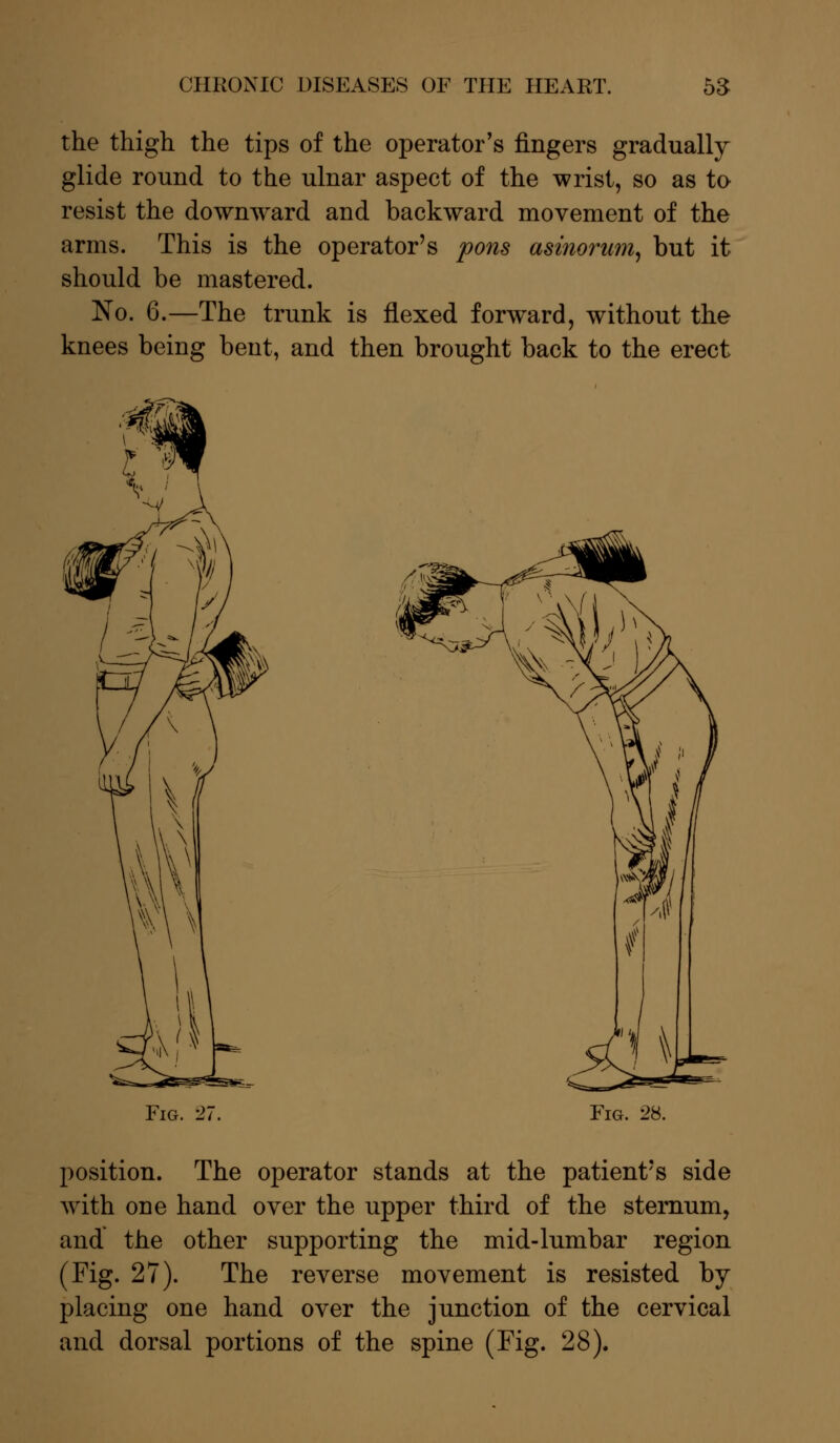 the thigh the tips of the operator's fingers gradually glide round to the ulnar aspect of the wrist, so as to resist the downward and backward movement of the arms. This is the operator's pons asinorum, but it should be mastered. No. 6.—The trunk is flexed forward, without the knees being bent, and then brought back to the erect Fig. 2; Fig. 28. position. The operator stands at the patient's side with one hand over the upper third of the sternum, and the other supporting the mid-lumbar region (Fig. 27). The reverse movement is resisted by placing one hand over the junction of the cervical and dorsal portions of the spine (Fig. 28).