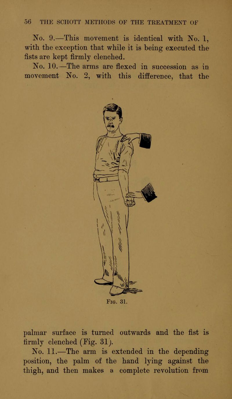 No. 9.—This movement is identical with No. 1, with the exception that while it is being executed the fists are kept firmly clenched. No. 10.—The arms are flexed in succession as in movement No. 2, with this difference, that the palmar surface is turned outwards and the fist is firmly clenched (Fig. 31 J. No. 11.—The arm is extended in the depending position, the palm of the hand lying against the thigh, and then makes a complete revolution from