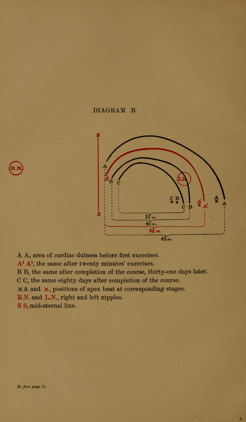 6i,N. A A, area of cardiac dulness before first exercises. A1 A1, the same after twenty minutes' exercises. B B, the same after completion of the course, thirty-one days later. C C, the same eighty days after completion of the course. X A and x, positions of apex beat at corresponding stages. R.N. and L.N., right and left nipples. S S, mid-sternal line.